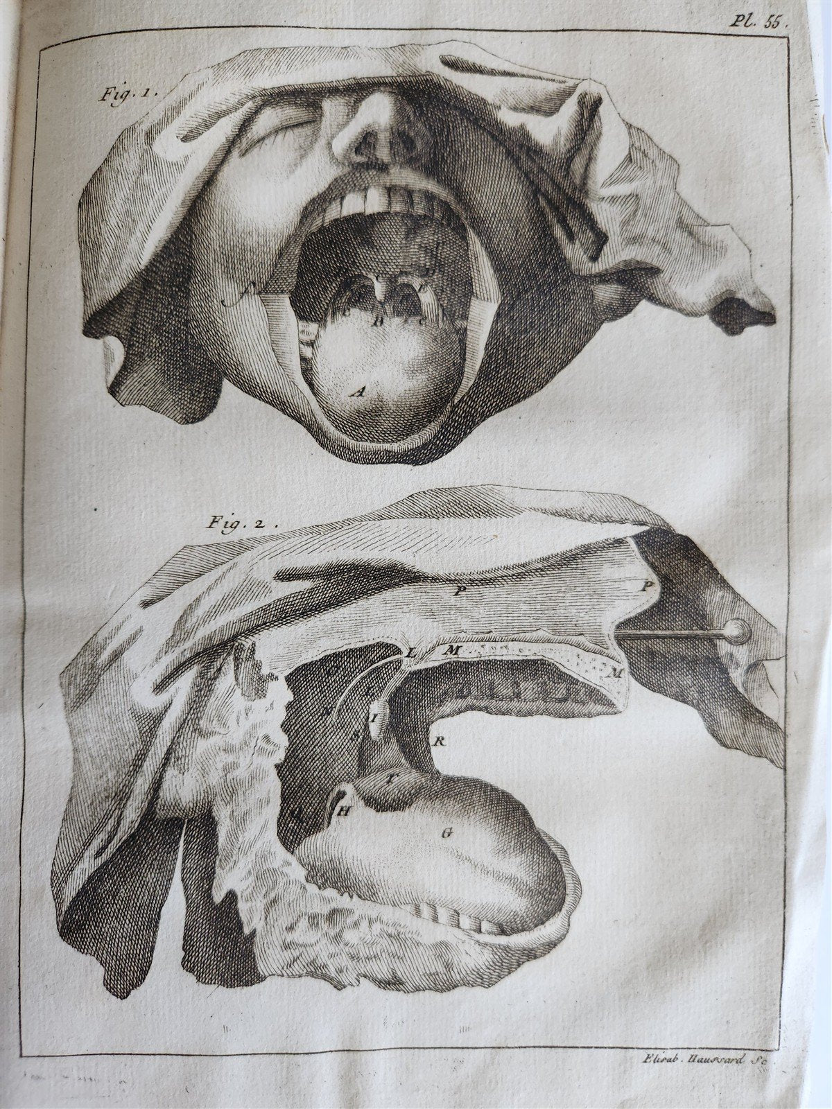 1750 MEDICAL TREATISE ILLUSTRATED ANATOMY by Francois PLANQUE antique V. 3