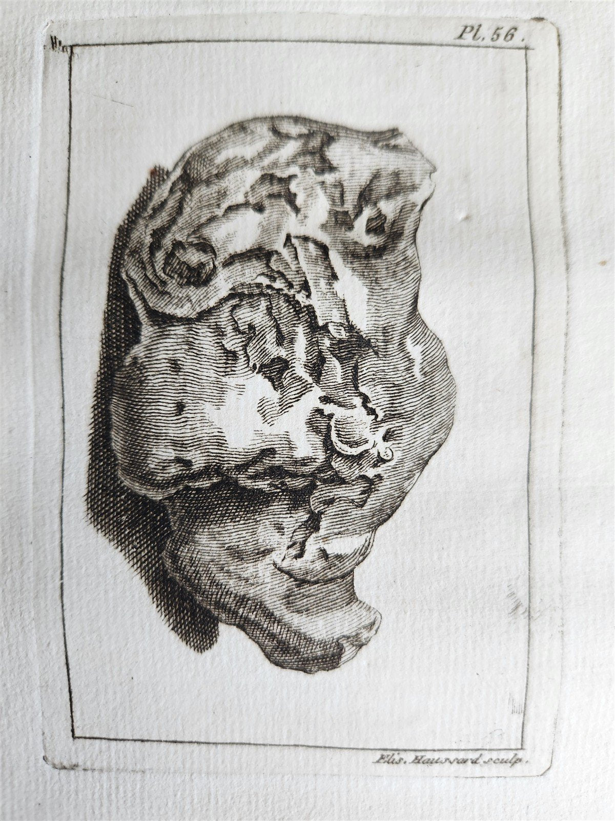 1750 MEDICAL TREATISE ILLUSTRATED ANATOMY by Francois PLANQUE antique V. 3