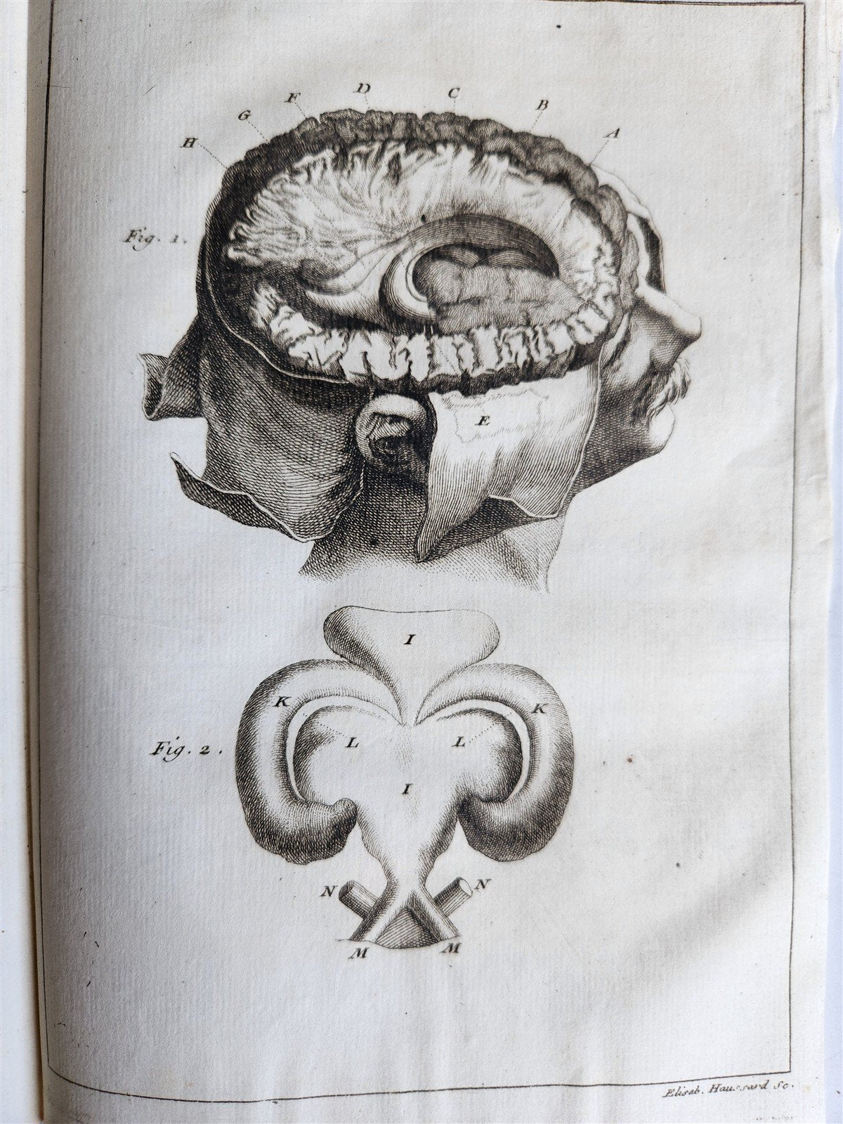 1750 MEDICAL TREATISE ILLUSTRATED ANATOMY by Francois PLANQUE antique V. 3