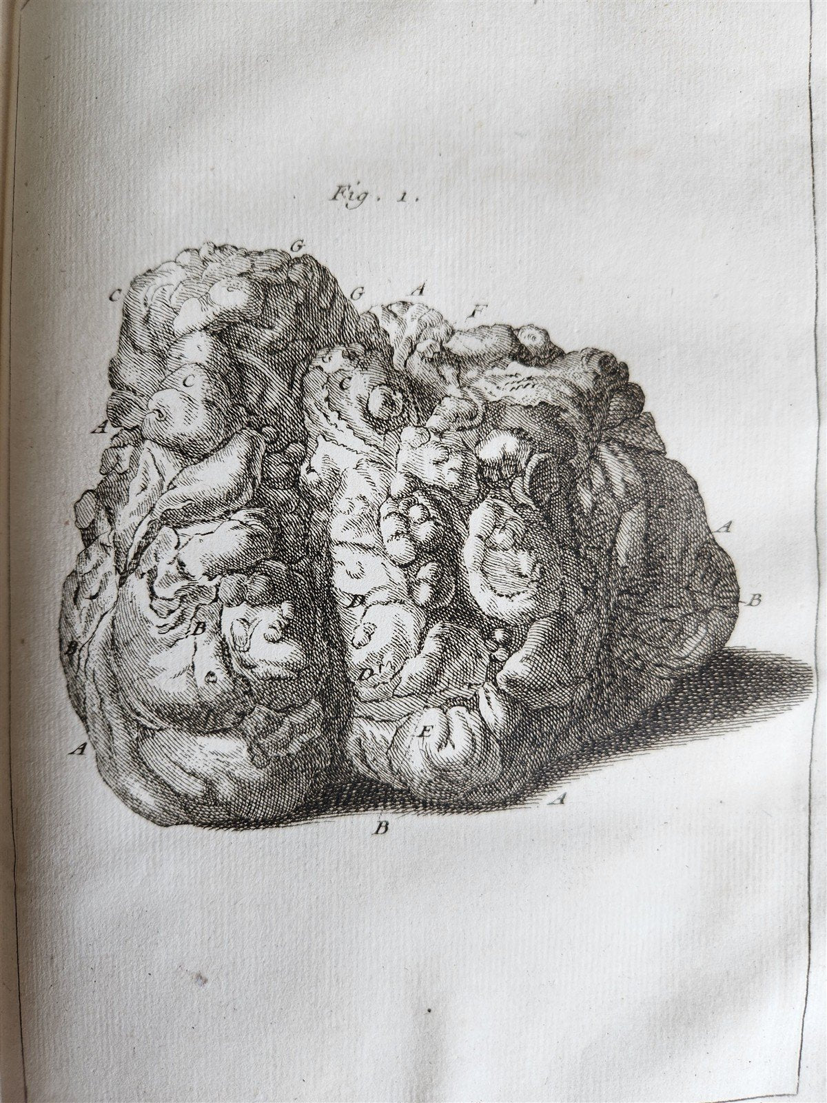 1750 MEDICAL TREATISE ILLUSTRATED ANATOMY by Francois PLANQUE antique V. 3