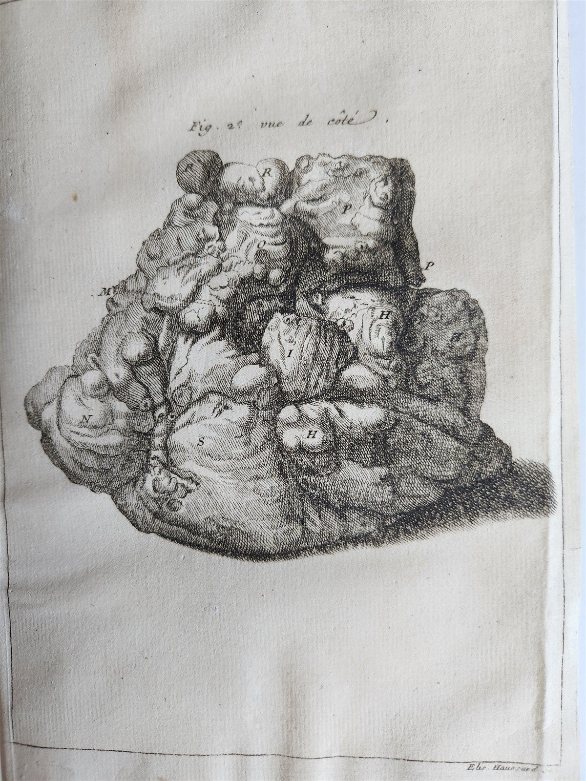 1750 MEDICAL TREATISE ILLUSTRATED ANATOMY by Francois PLANQUE antique V. 3