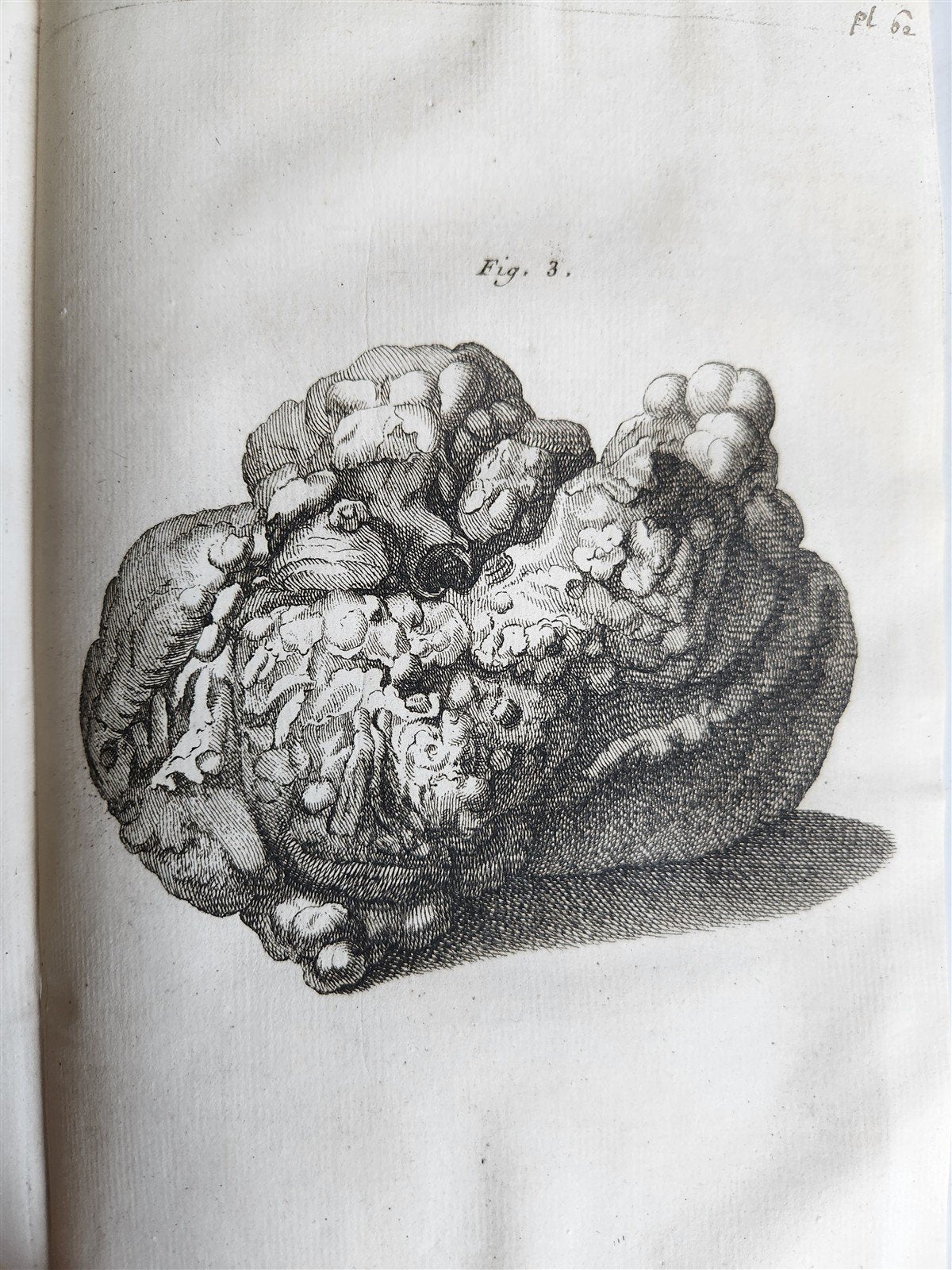 1750 MEDICAL TREATISE ILLUSTRATED ANATOMY by Francois PLANQUE antique V. 3