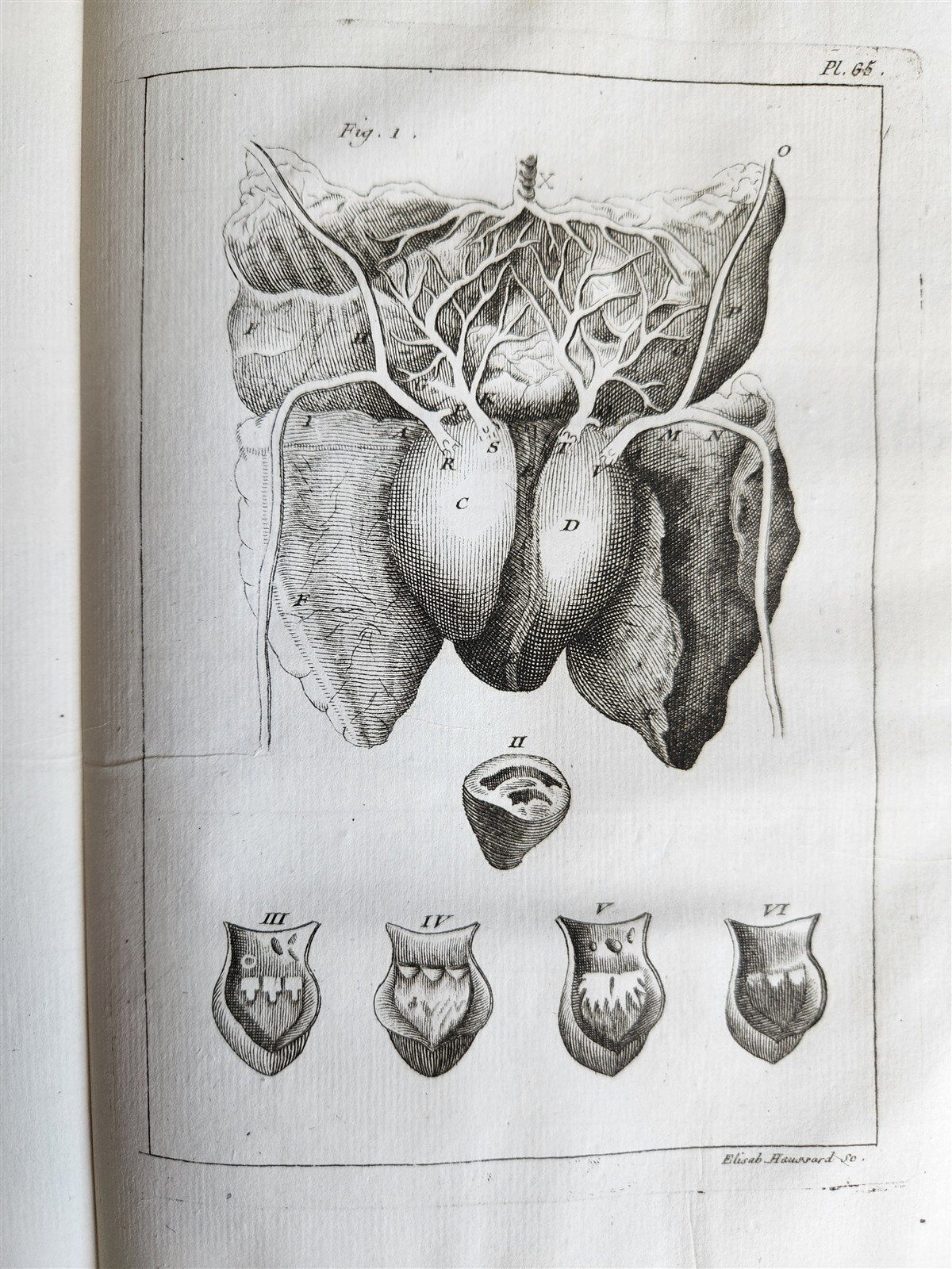 1750 MEDICAL TREATISE ILLUSTRATED ANATOMY by Francois PLANQUE antique V. 3