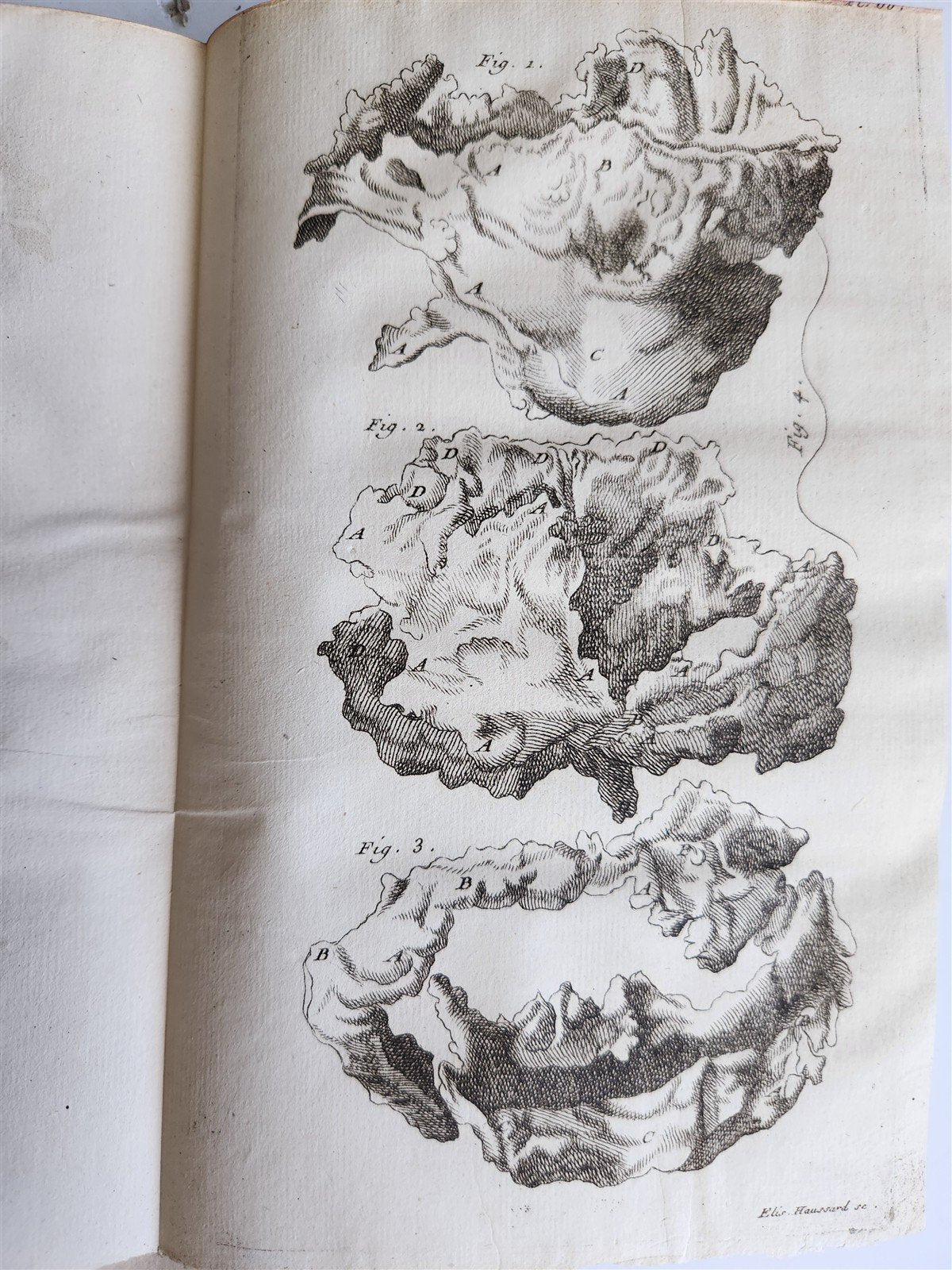 1750 MEDICAL TREATISE ILLUSTRATED ANATOMY by Francois PLANQUE antique V. 3
