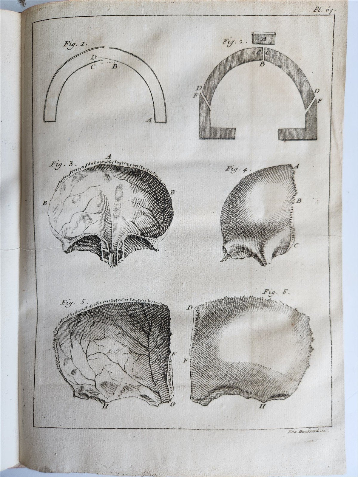 1750 MEDICAL TREATISE ILLUSTRATED ANATOMY by Francois PLANQUE antique V. 3