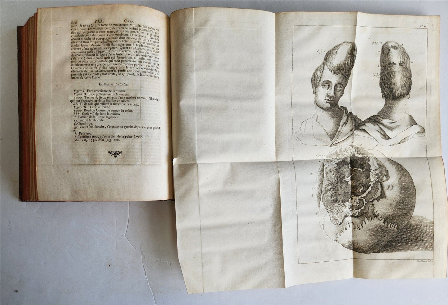 1750 MEDICAL TREATISE ILLUSTRATED ANATOMY by Francois PLANQUE antique V. 3