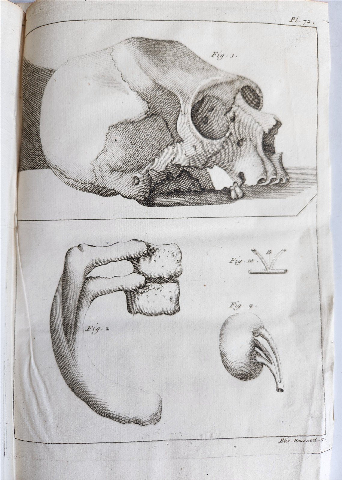 1750 MEDICAL TREATISE ILLUSTRATED ANATOMY by Francois PLANQUE antique V. 3