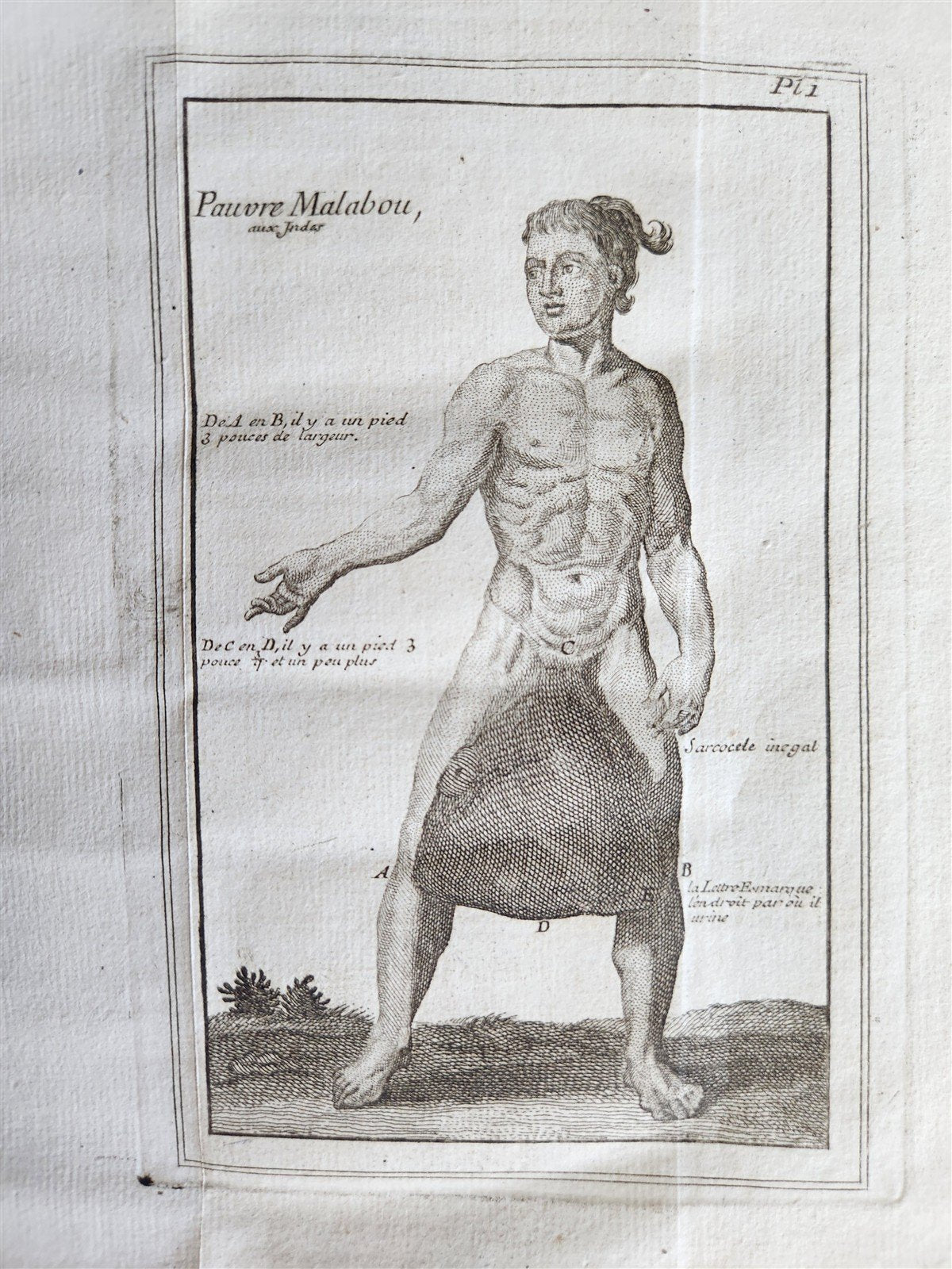 1748 MEDICAL TREATISE ILLUSTRATED ANATOMY by Francois PLANQUE antique V. 1