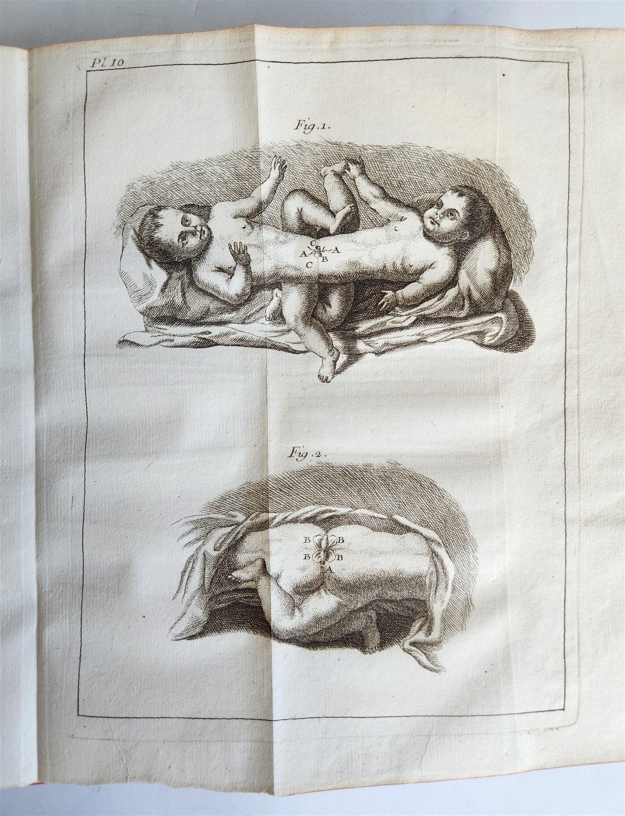 1748 MEDICAL TREATISE ILLUSTRATED ANATOMY by Francois PLANQUE antique V. 1