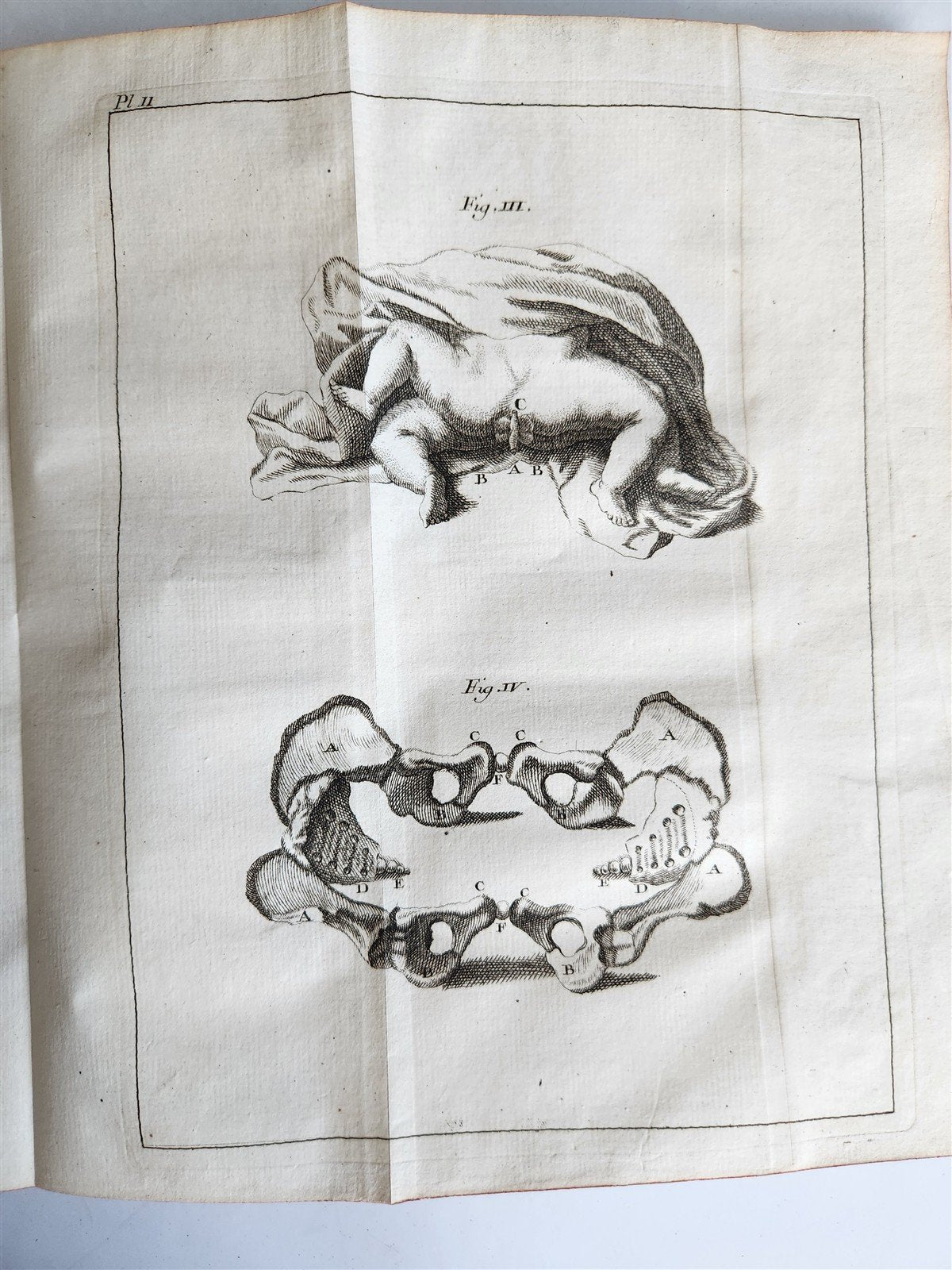 1748 MEDICAL TREATISE ILLUSTRATED ANATOMY by Francois PLANQUE antique V. 1