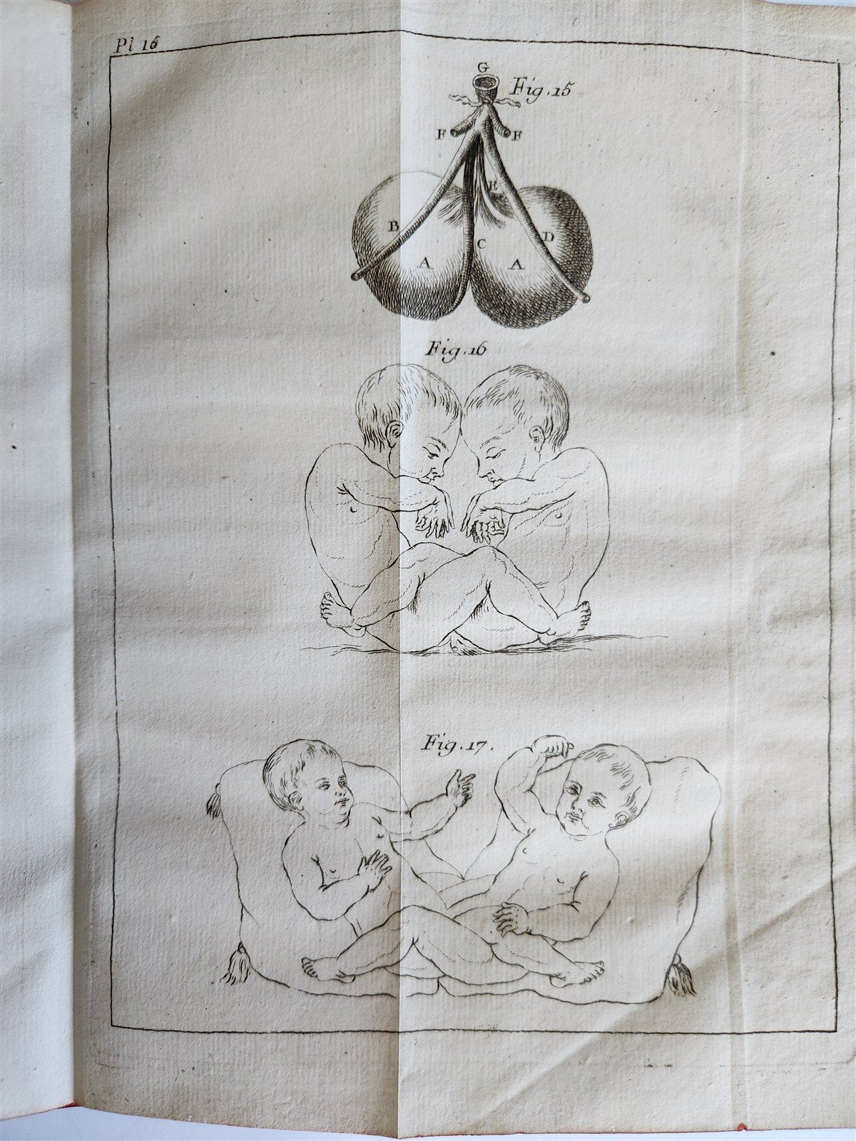 1748 MEDICAL TREATISE ILLUSTRATED ANATOMY by Francois PLANQUE antique V. 1