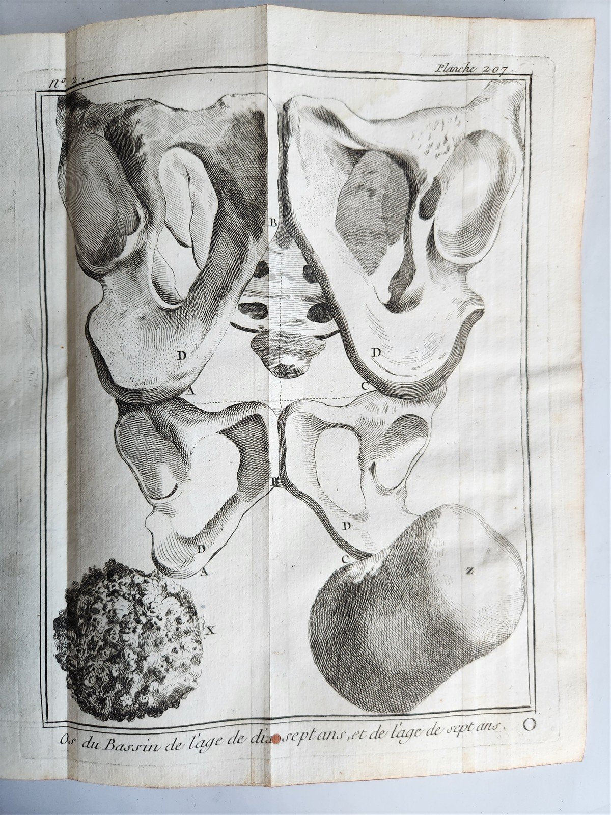 1770 MEDICAL TREATISE ILLUSTRATED ANATOMY by Francois PLANQUE antique V. 10