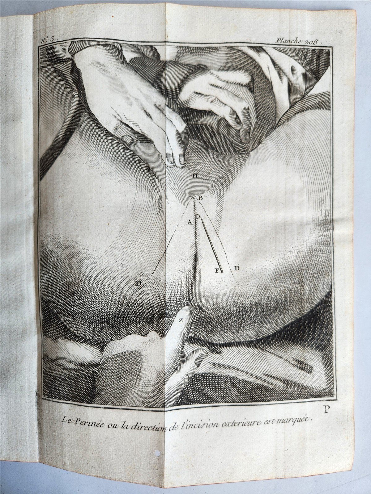 1770 MEDICAL TREATISE ILLUSTRATED ANATOMY by Francois PLANQUE antique V. 10