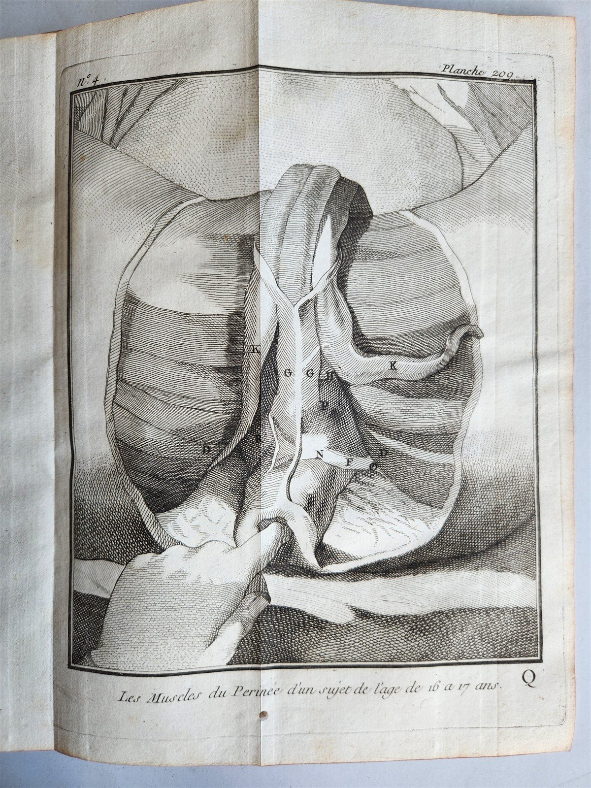 1770 MEDICAL TREATISE ILLUSTRATED ANATOMY by Francois PLANQUE antique V. 10