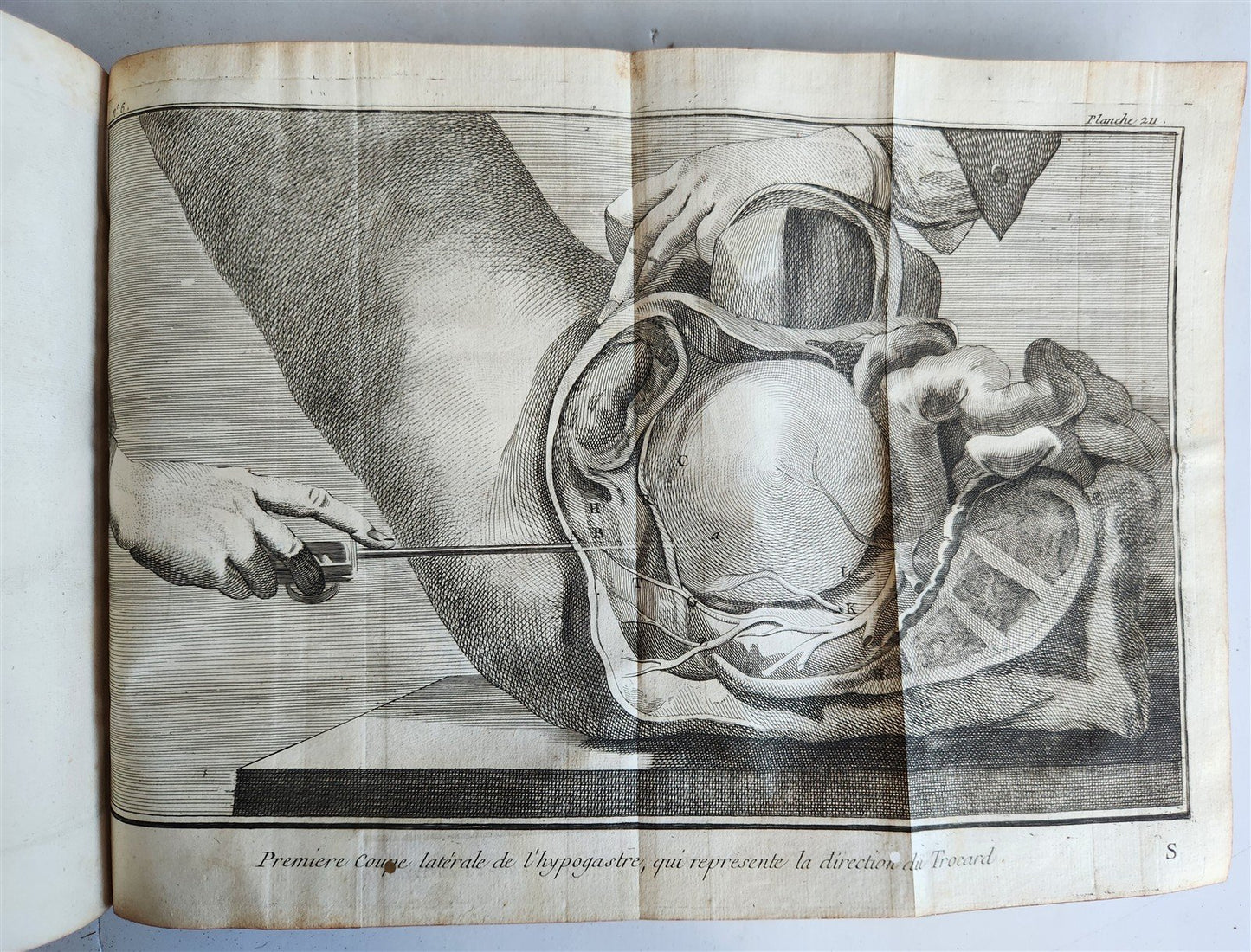 1770 MEDICAL TREATISE ILLUSTRATED ANATOMY by Francois PLANQUE antique V. 10