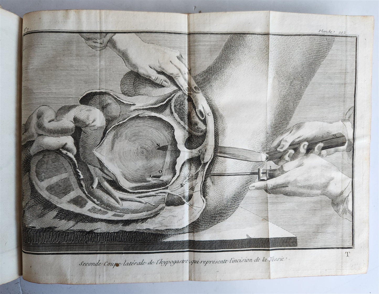 1770 MEDICAL TREATISE ILLUSTRATED ANATOMY by Francois PLANQUE antique V. 10