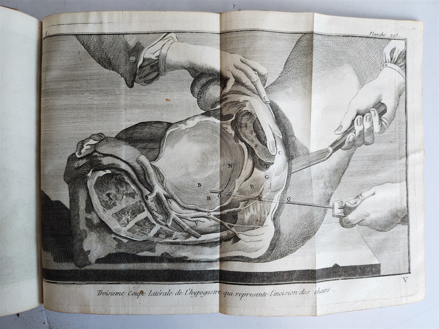 1770 MEDICAL TREATISE ILLUSTRATED ANATOMY by Francois PLANQUE antique V. 10
