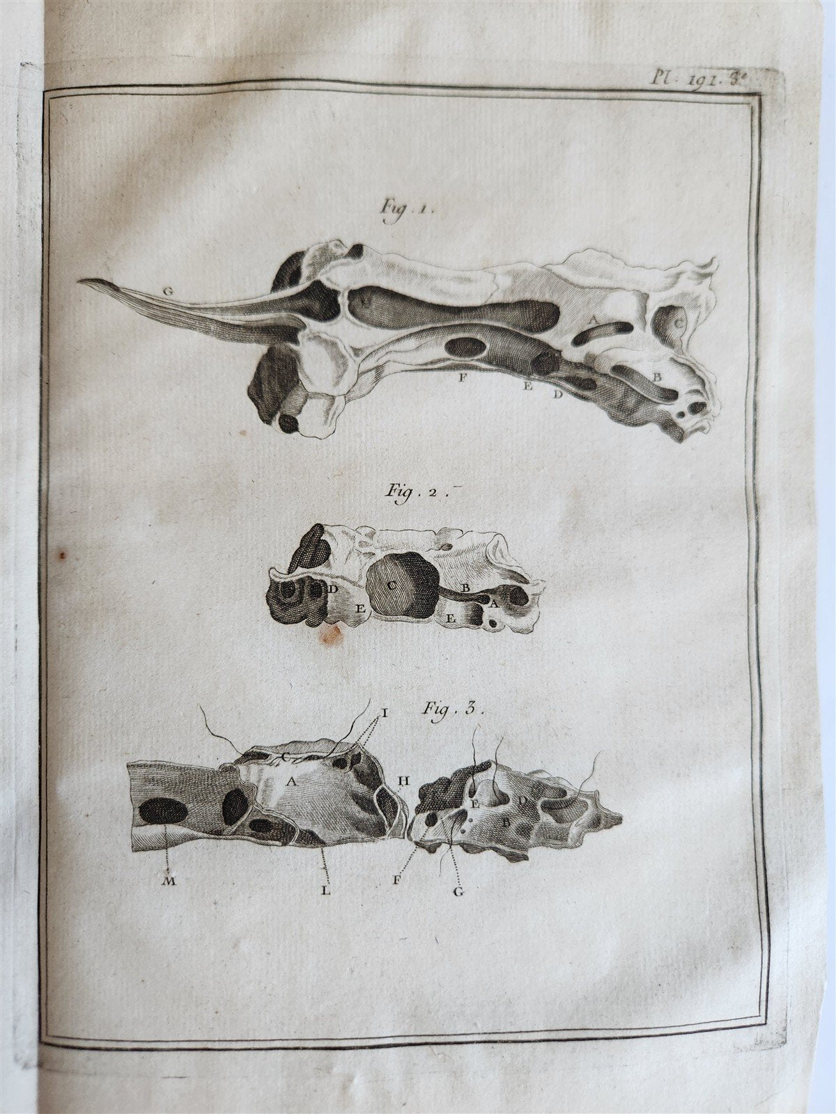 1766 MEDICAL TREATISE ILLUSTRATED ANATOMY by Francois PLANQUE antique V. 9