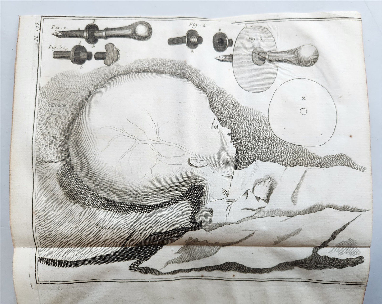 1766 MEDICAL TREATISE ILLUSTRATED ANATOMY by Francois PLANQUE antique V. 9