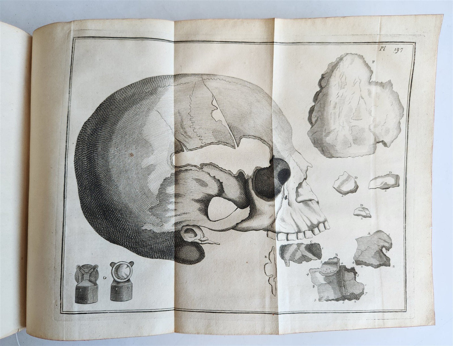1766 MEDICAL TREATISE ILLUSTRATED ANATOMY by Francois PLANQUE antique V. 9