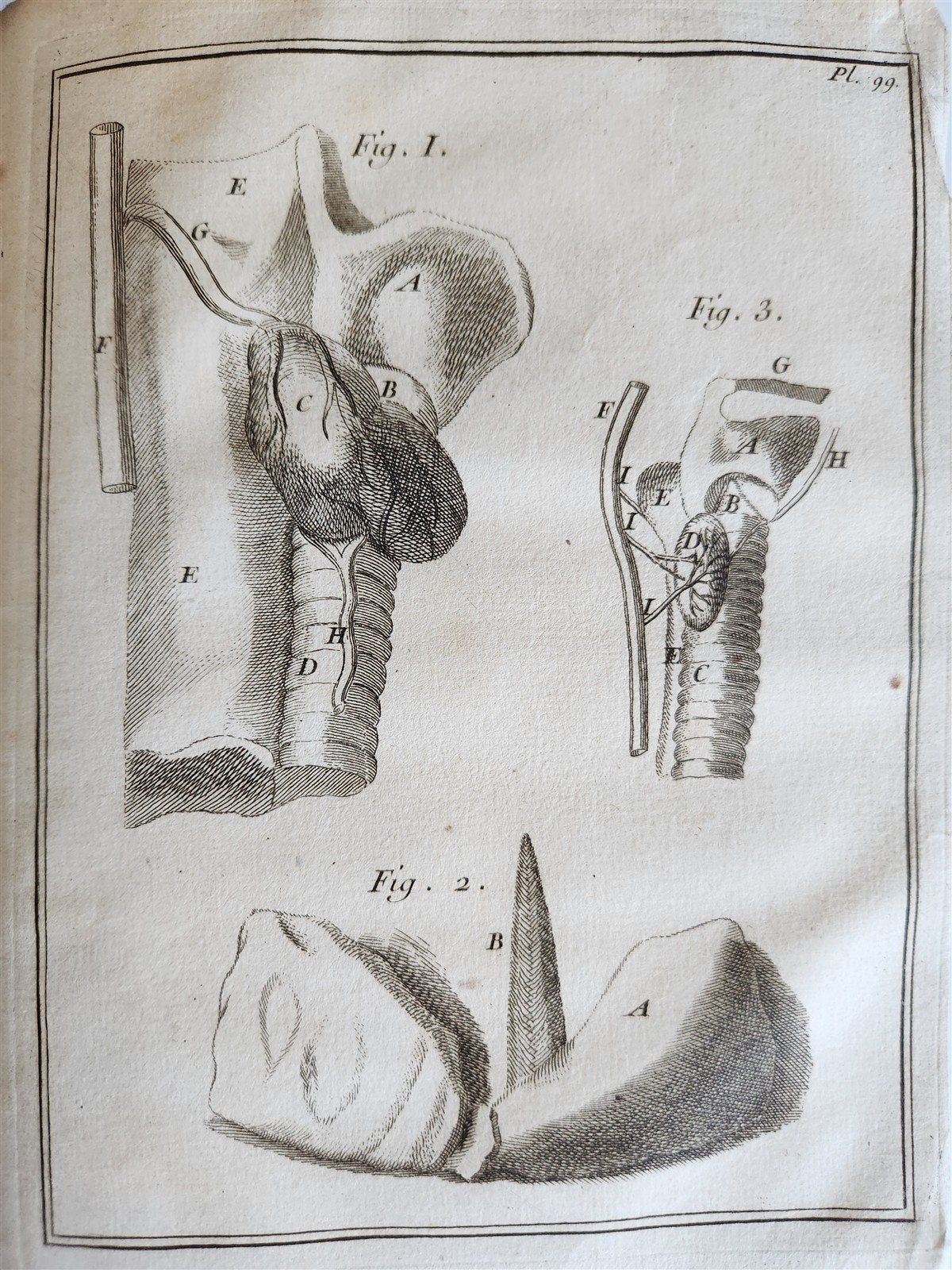 1759 MEDICAL TREATISE ILLUSTRATED ANATOMY by Francois PLANQUE antique V. 5