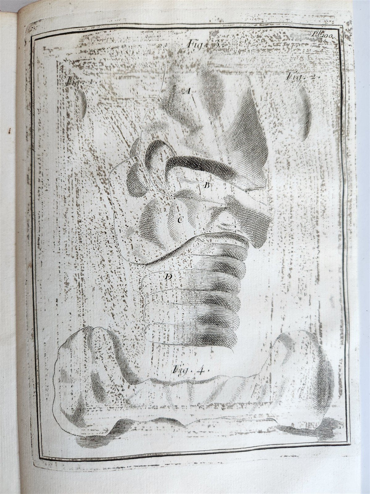 1759 MEDICAL TREATISE ILLUSTRATED ANATOMY by Francois PLANQUE antique V. 5