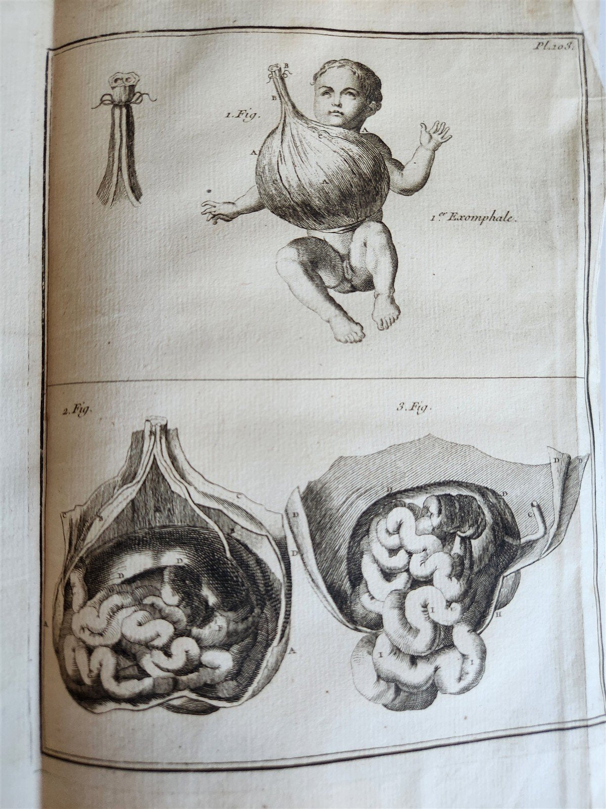 1759 MEDICAL TREATISE ILLUSTRATED ANATOMY by Francois PLANQUE antique V. 5