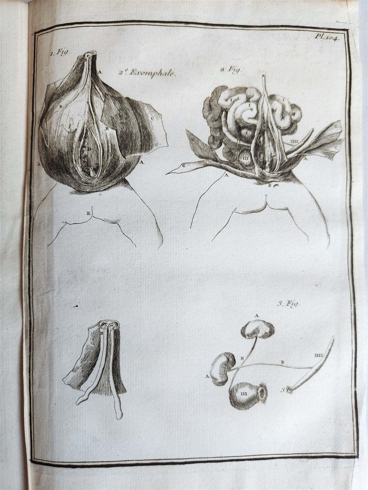 1759 MEDICAL TREATISE ILLUSTRATED ANATOMY by Francois PLANQUE antique V. 5