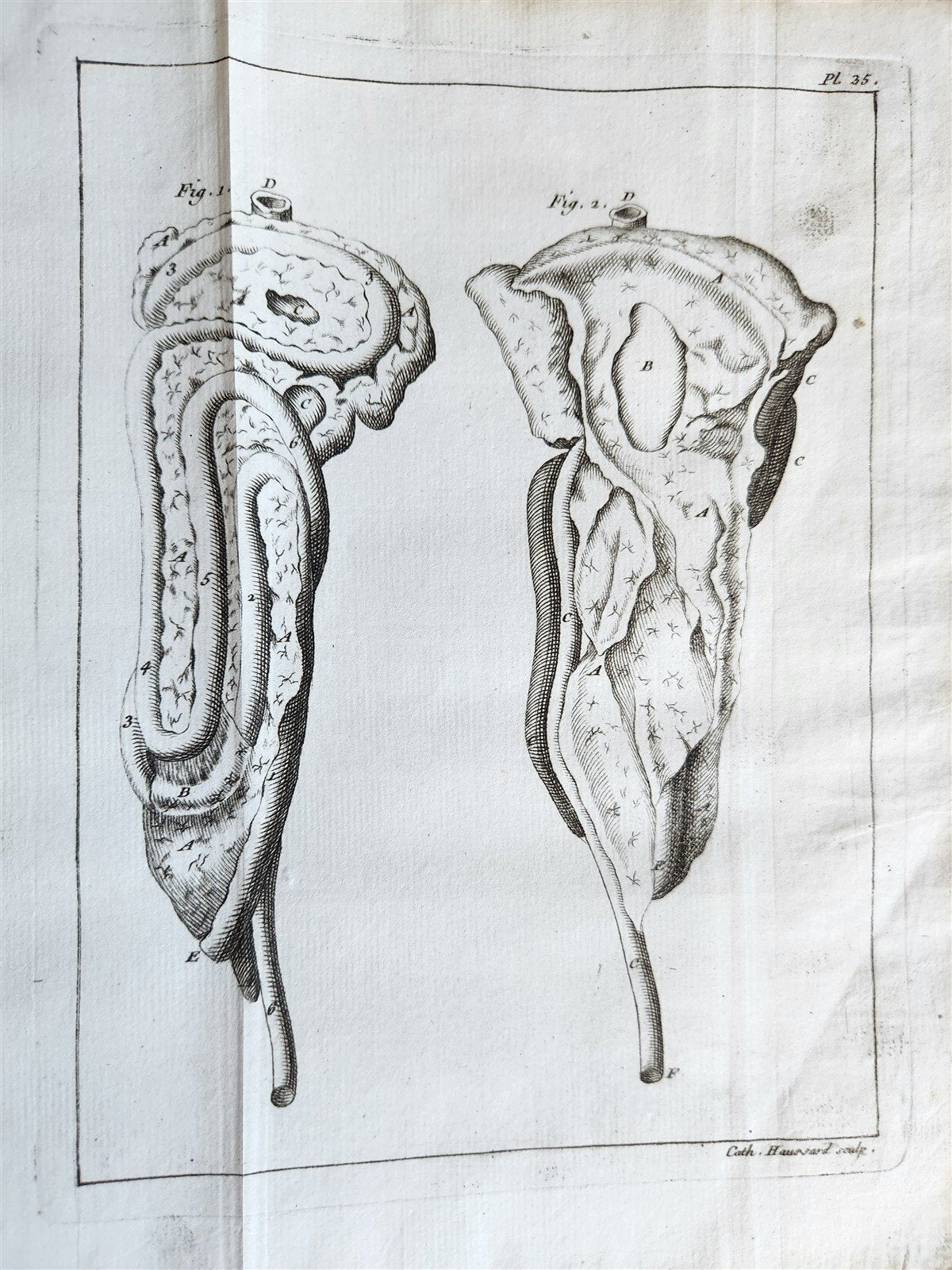 1749 MEDICAL TREATISE ILLUSTRATED ANATOMY by Francois PLANQUE antique V. 2