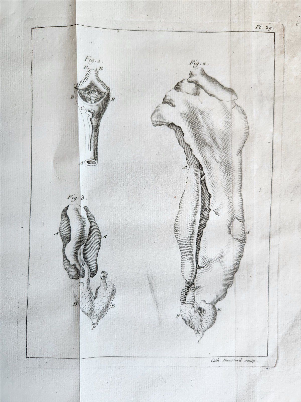 1749 MEDICAL TREATISE ILLUSTRATED ANATOMY by Francois PLANQUE antique V. 2