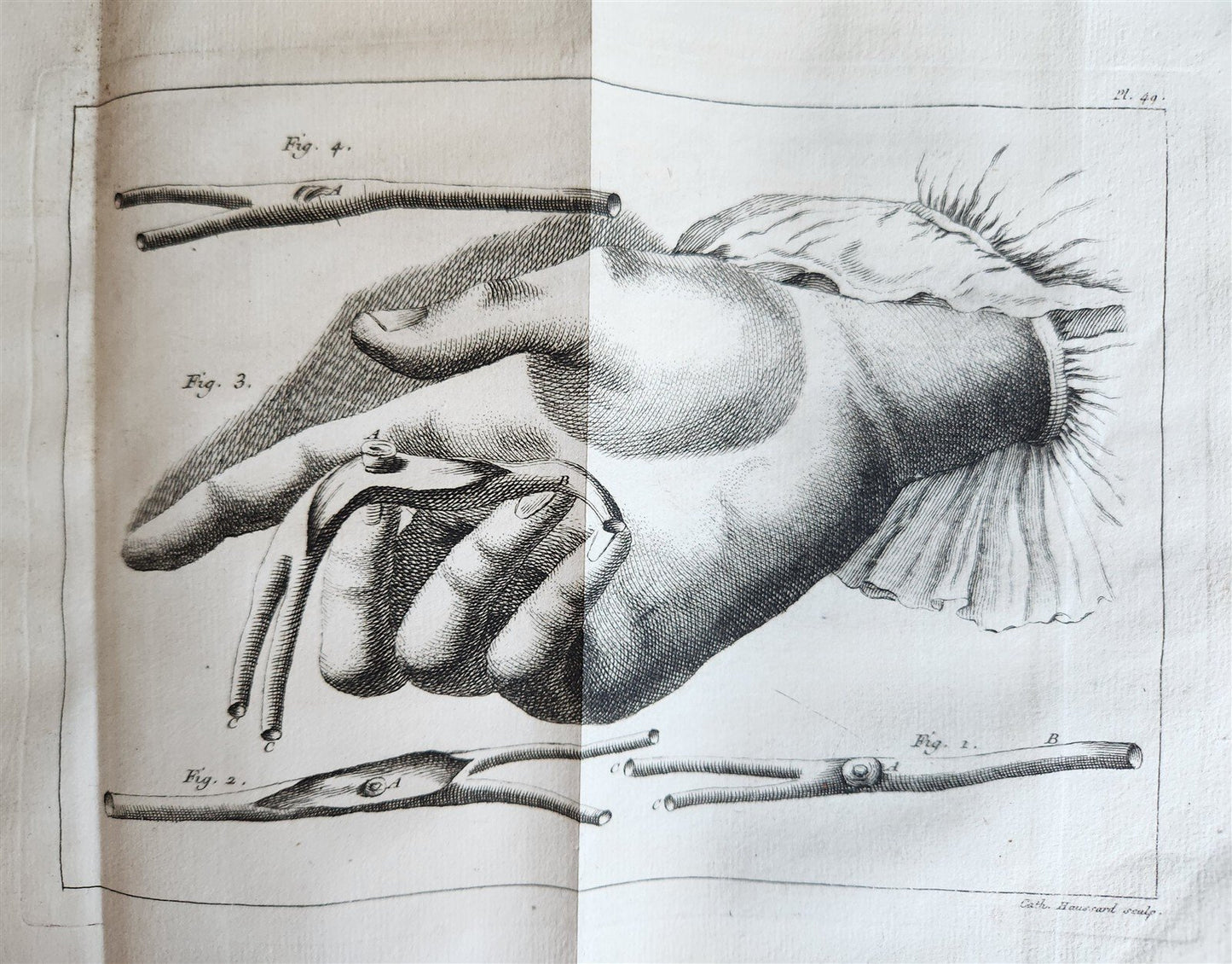 1749 MEDICAL TREATISE ILLUSTRATED ANATOMY by Francois PLANQUE antique V. 2
