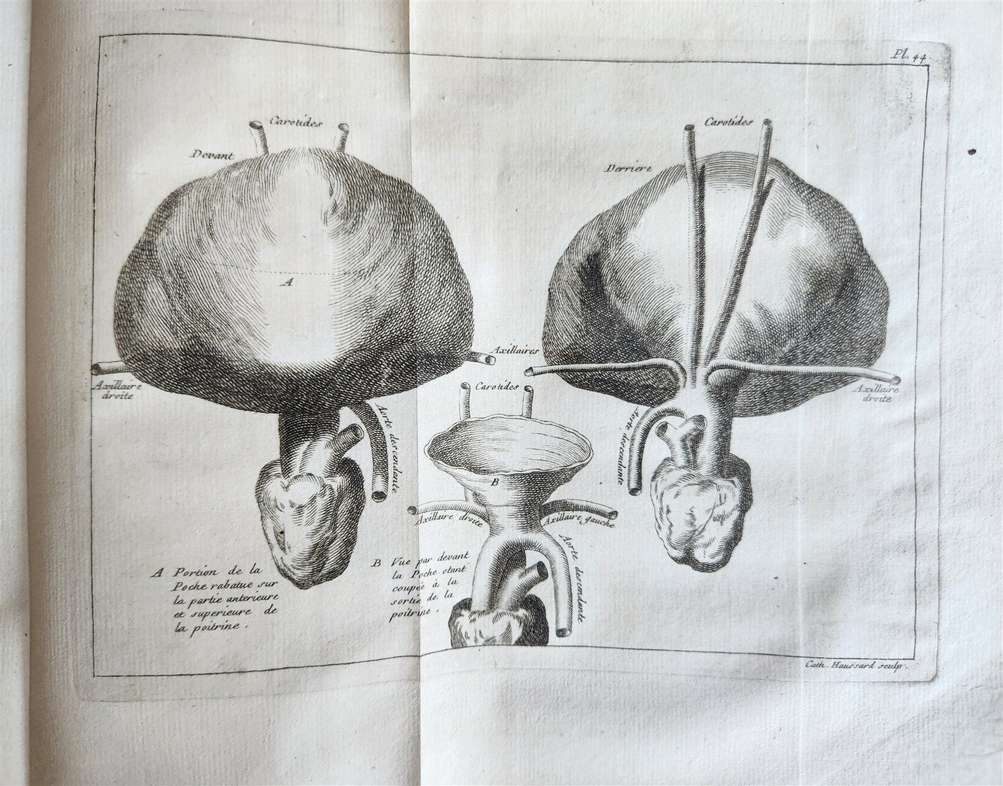 1749 MEDICAL TREATISE ILLUSTRATED ANATOMY by Francois PLANQUE antique V. 2