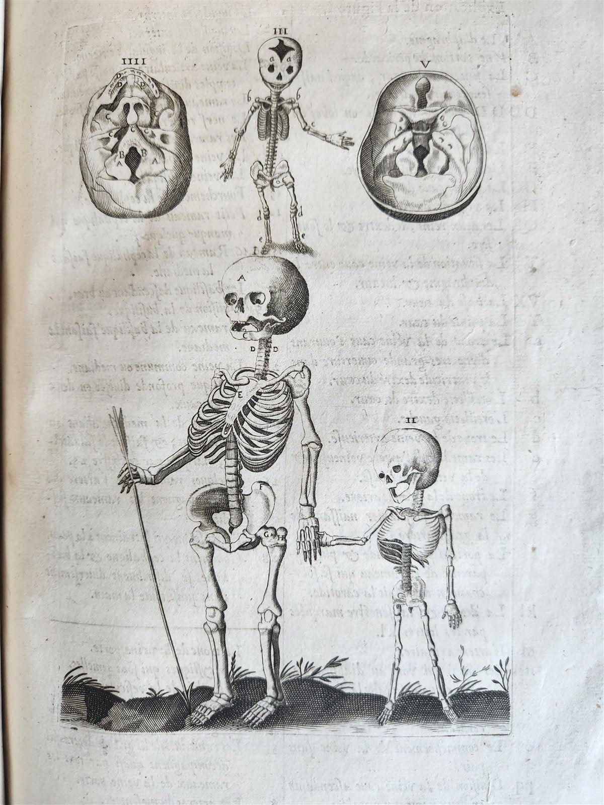1646 ANATOMY ILLUSTRATED FOLIO antique MEDICAL Oeuvres de Me André dv Lavrens