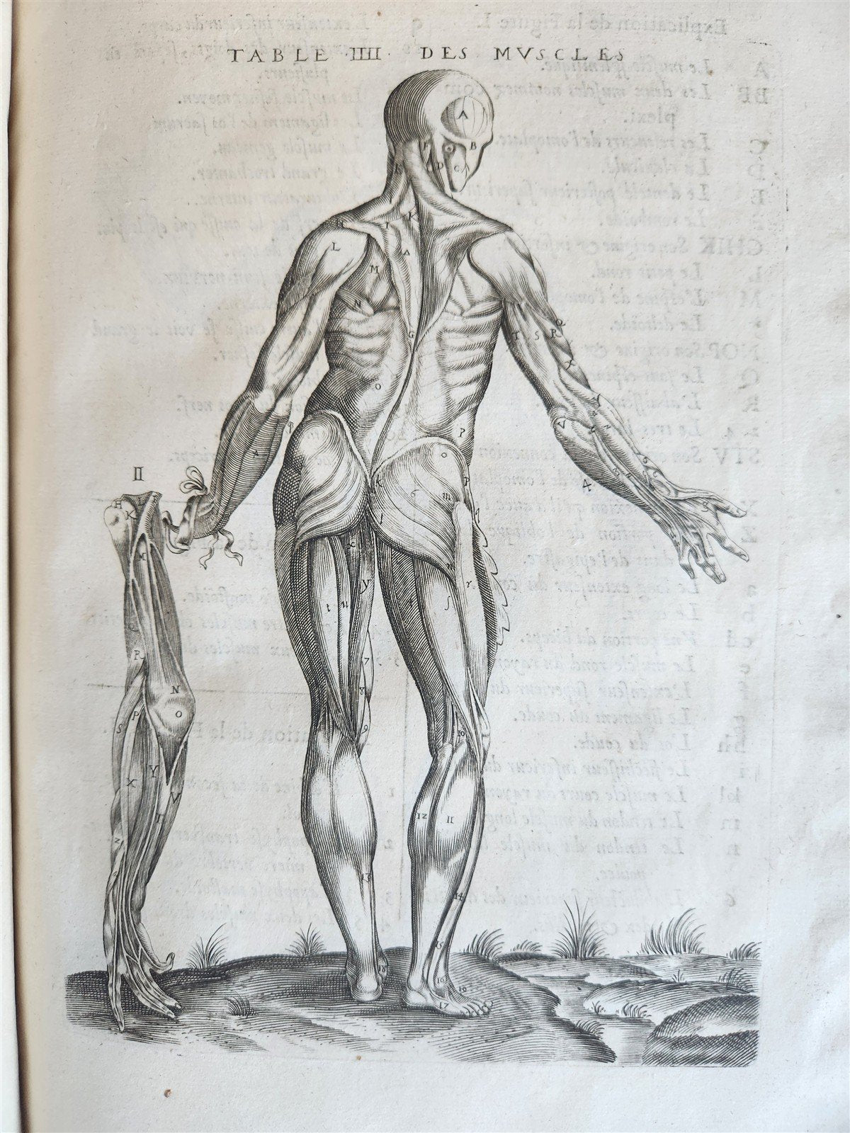 1646 ANATOMY ILLUSTRATED FOLIO antique MEDICAL Oeuvres de Me André dv Lavrens
