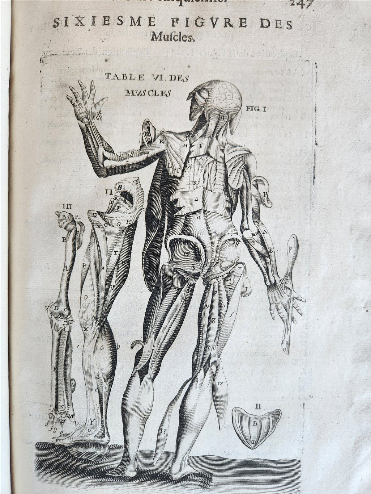 1646 ANATOMY ILLUSTRATED FOLIO antique MEDICAL Oeuvres de Me André dv Lavrens