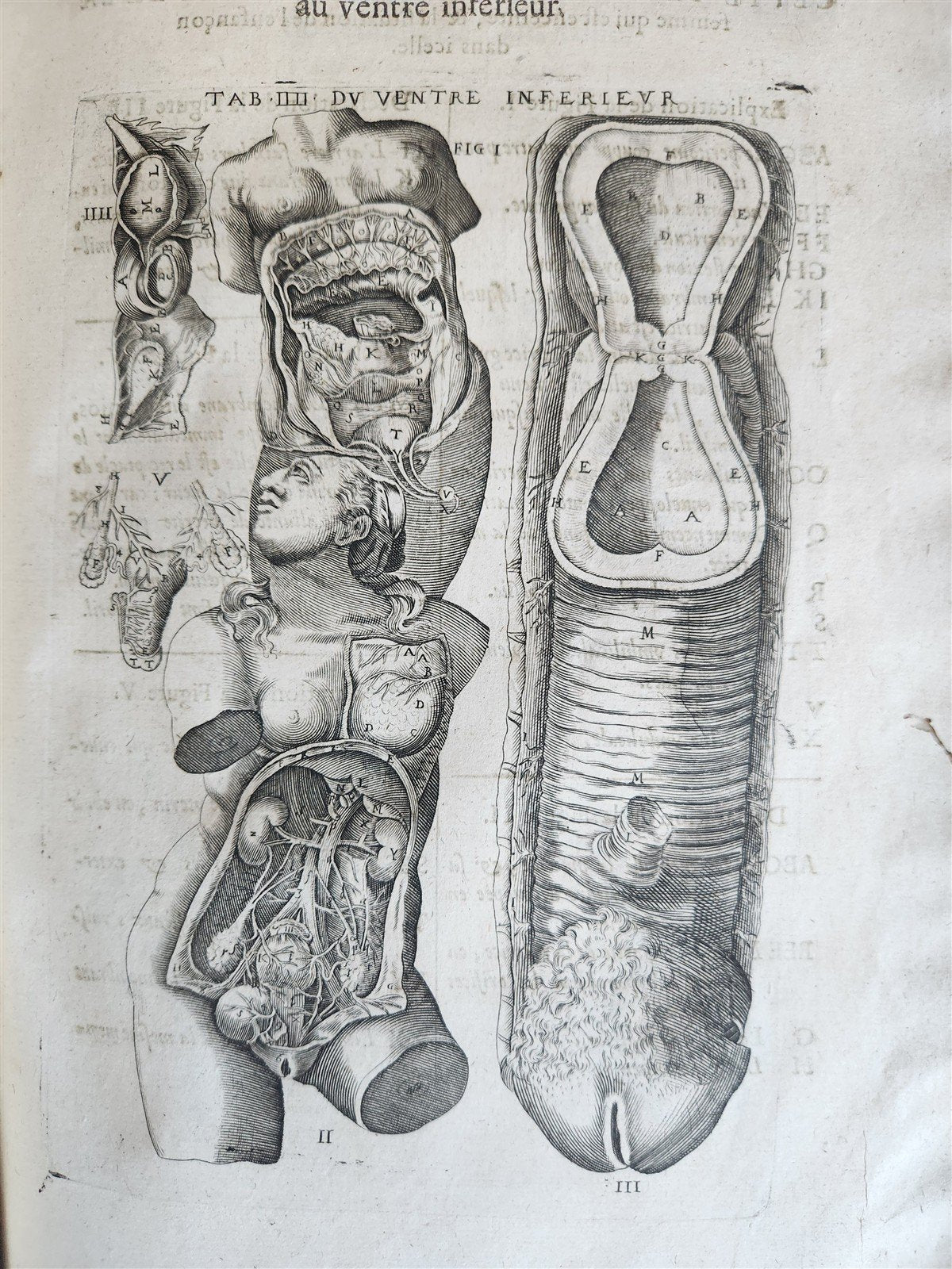 1646 ANATOMY ILLUSTRATED FOLIO antique MEDICAL Oeuvres de Me André dv Lavrens