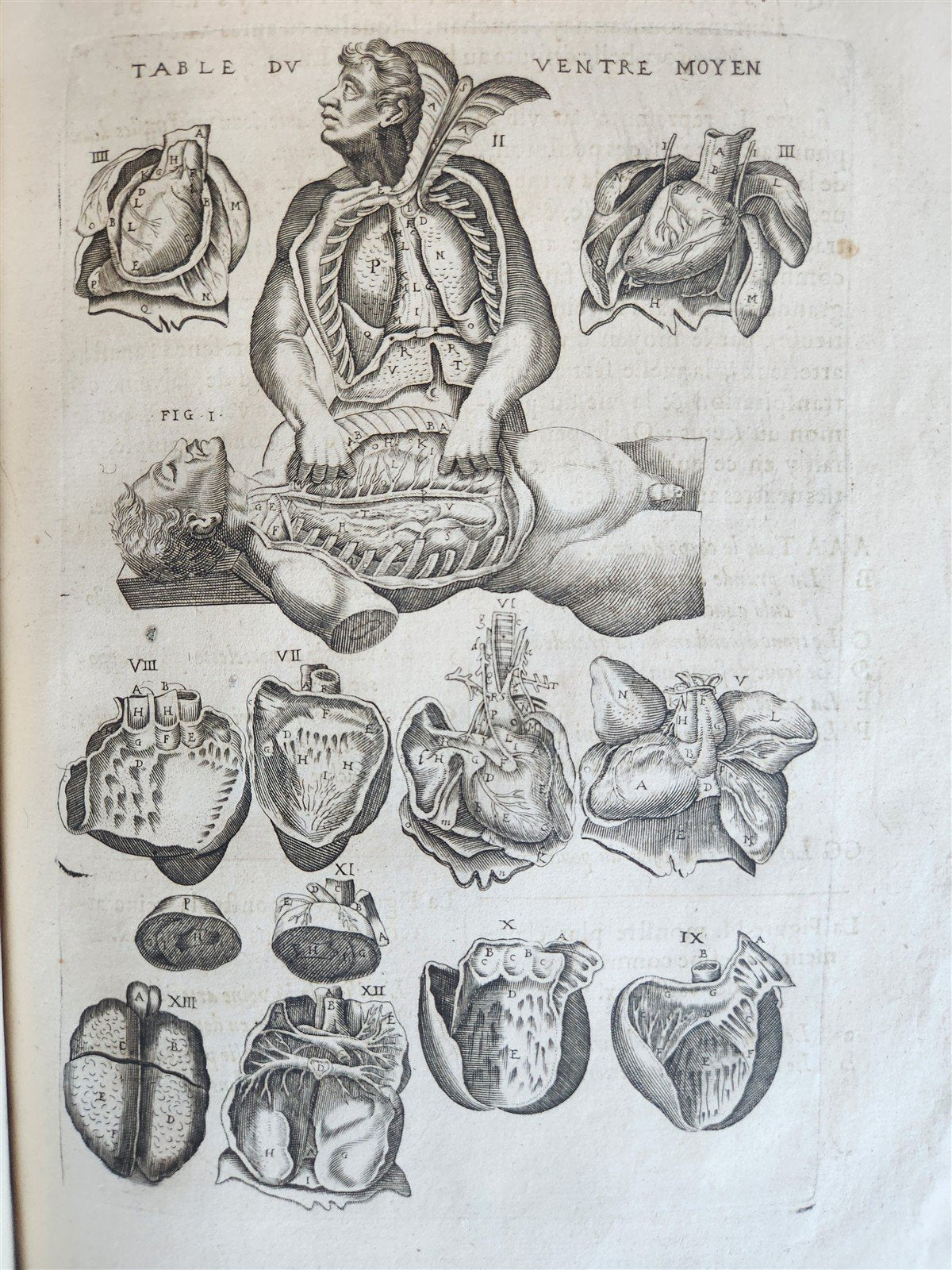 1646 ANATOMY ILLUSTRATED FOLIO antique MEDICAL Oeuvres de Me André dv Lavrens