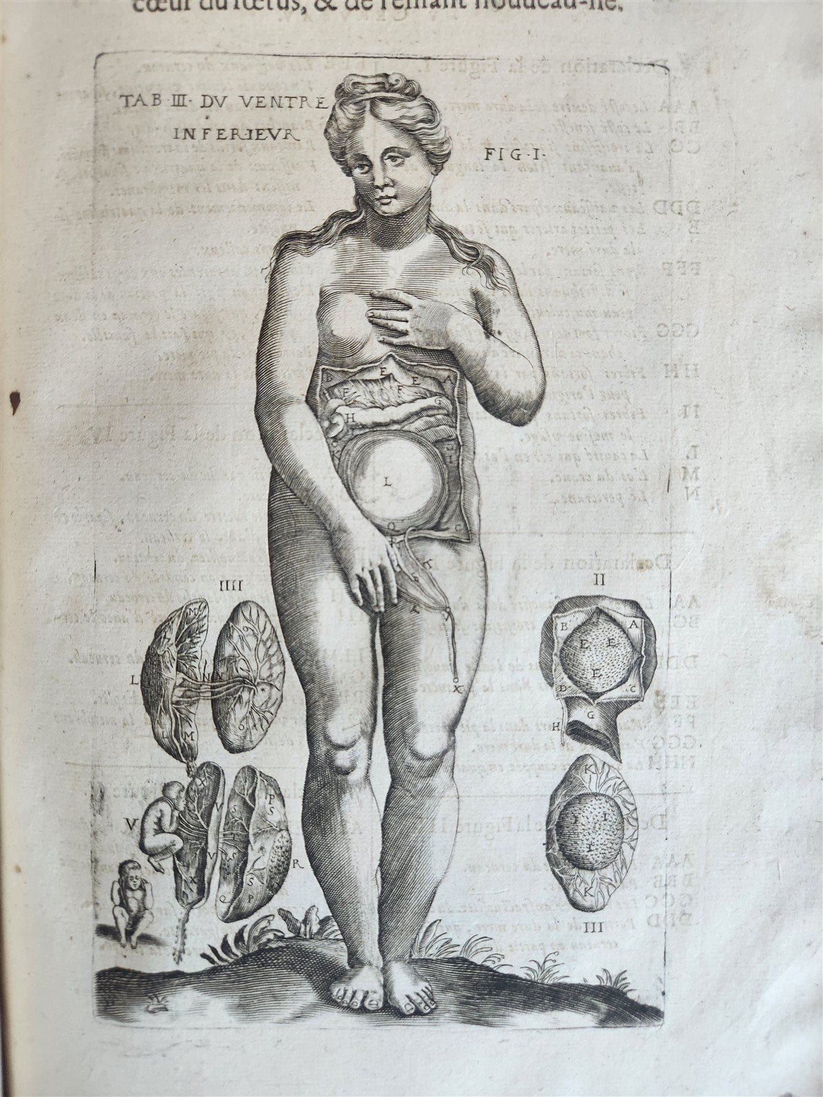 1646 ANATOMY ILLUSTRATED FOLIO antique MEDICAL Oeuvres de Me André dv Lavrens