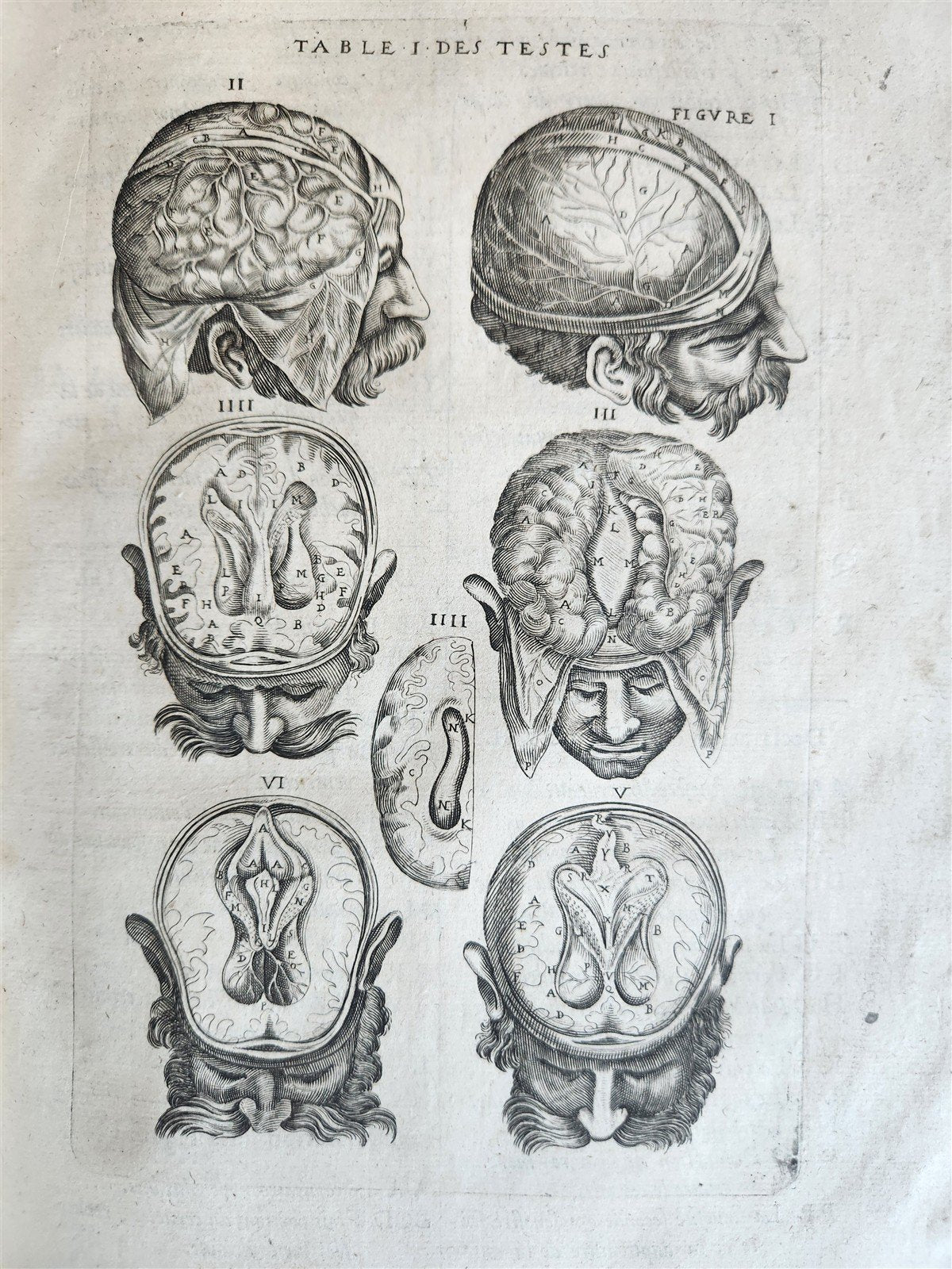 1646 ANATOMY ILLUSTRATED FOLIO antique MEDICAL Oeuvres de Me André dv Lavrens