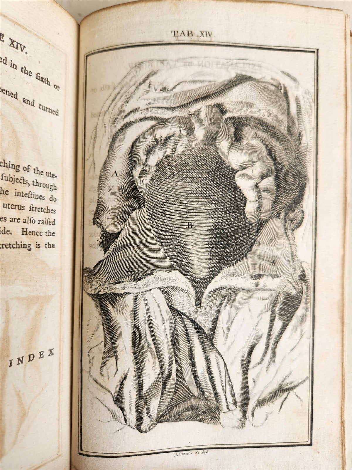 1791 System of Anatomy & Physiology ANTIQUE 3 vols. ILLUSTRATED