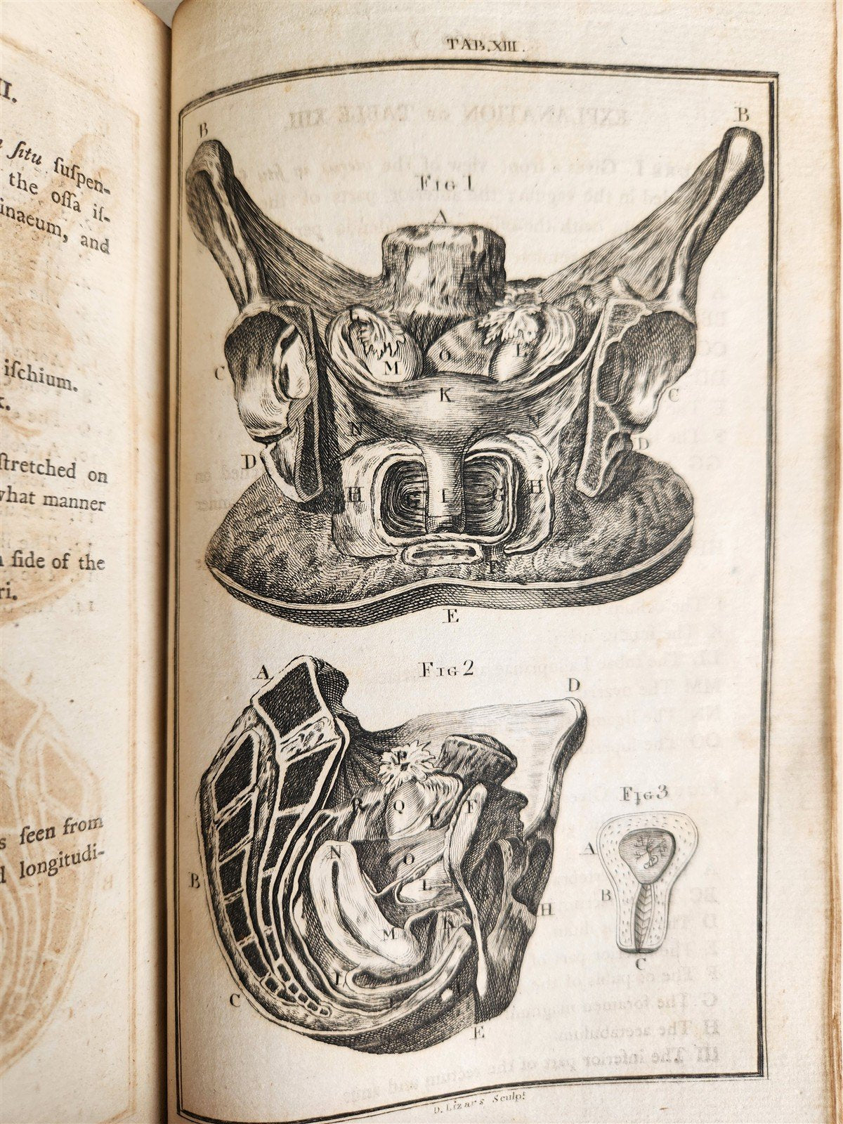 1791 System of Anatomy & Physiology ANTIQUE 3 vols. ILLUSTRATED
