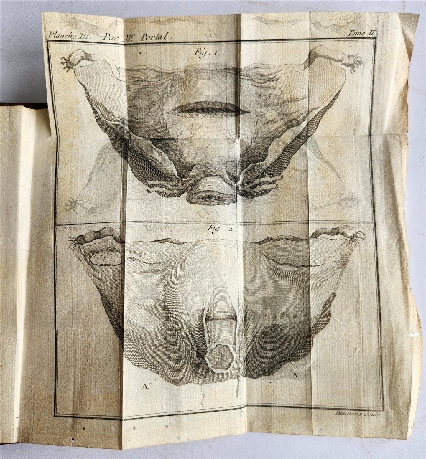 1777 ANATOMIE HISTORIQUE et PRATIQUE antique ILLUSTRATED