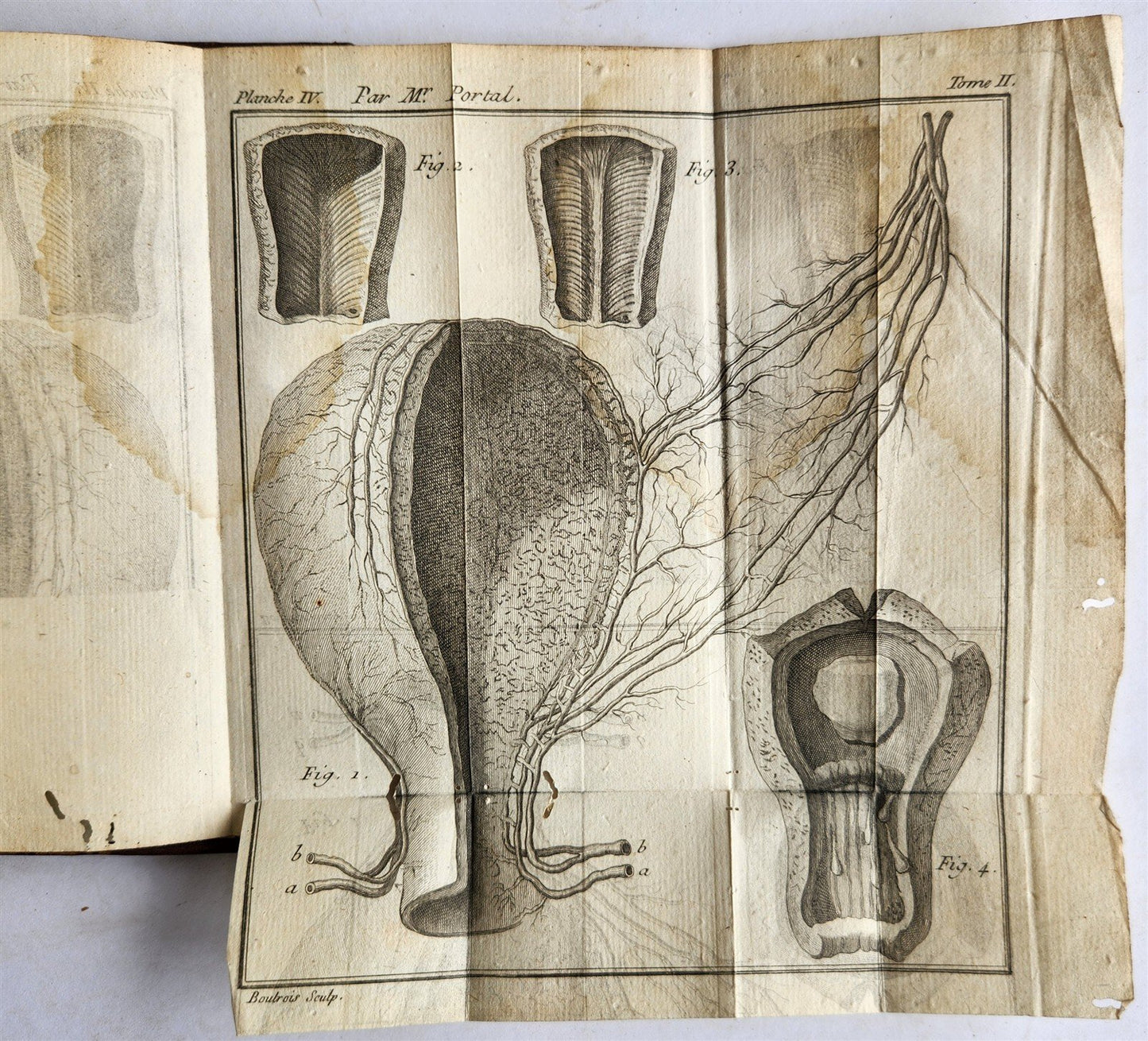 1777 ANATOMIE HISTORIQUE et PRATIQUE antique ILLUSTRATED