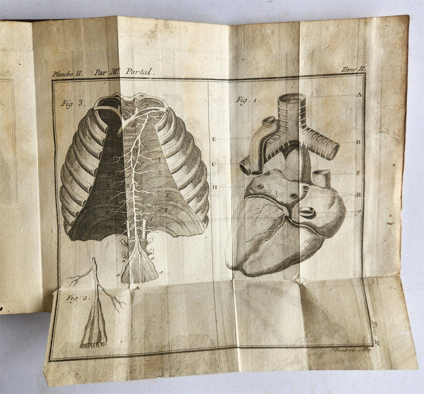 1777 ANATOMIE HISTORIQUE et PRATIQUE antique ILLUSTRATED