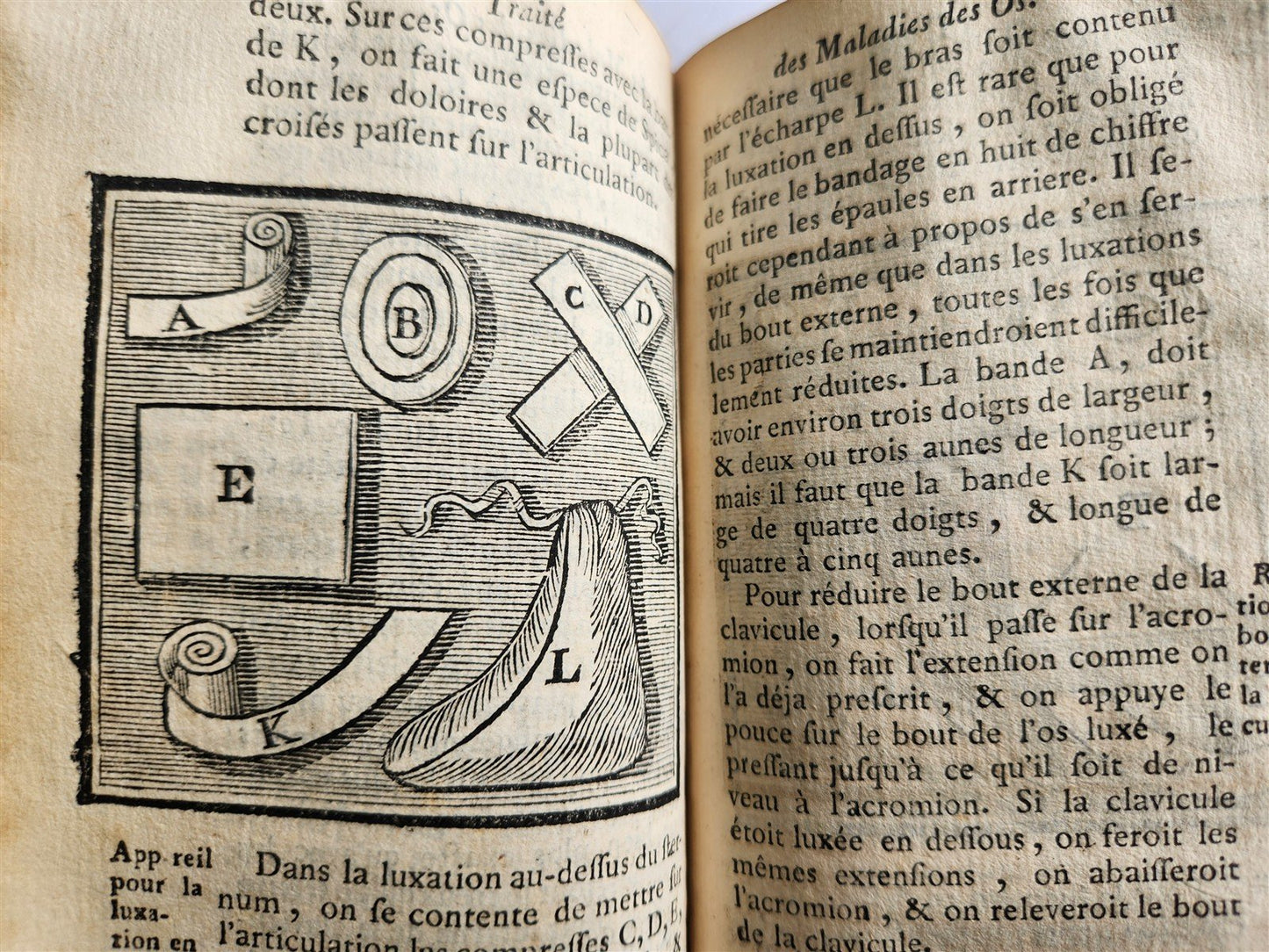 1775 Treatise on Diseases of Bones ILLUSTRATED MEDICAL DEVICES antique 2 VOLS