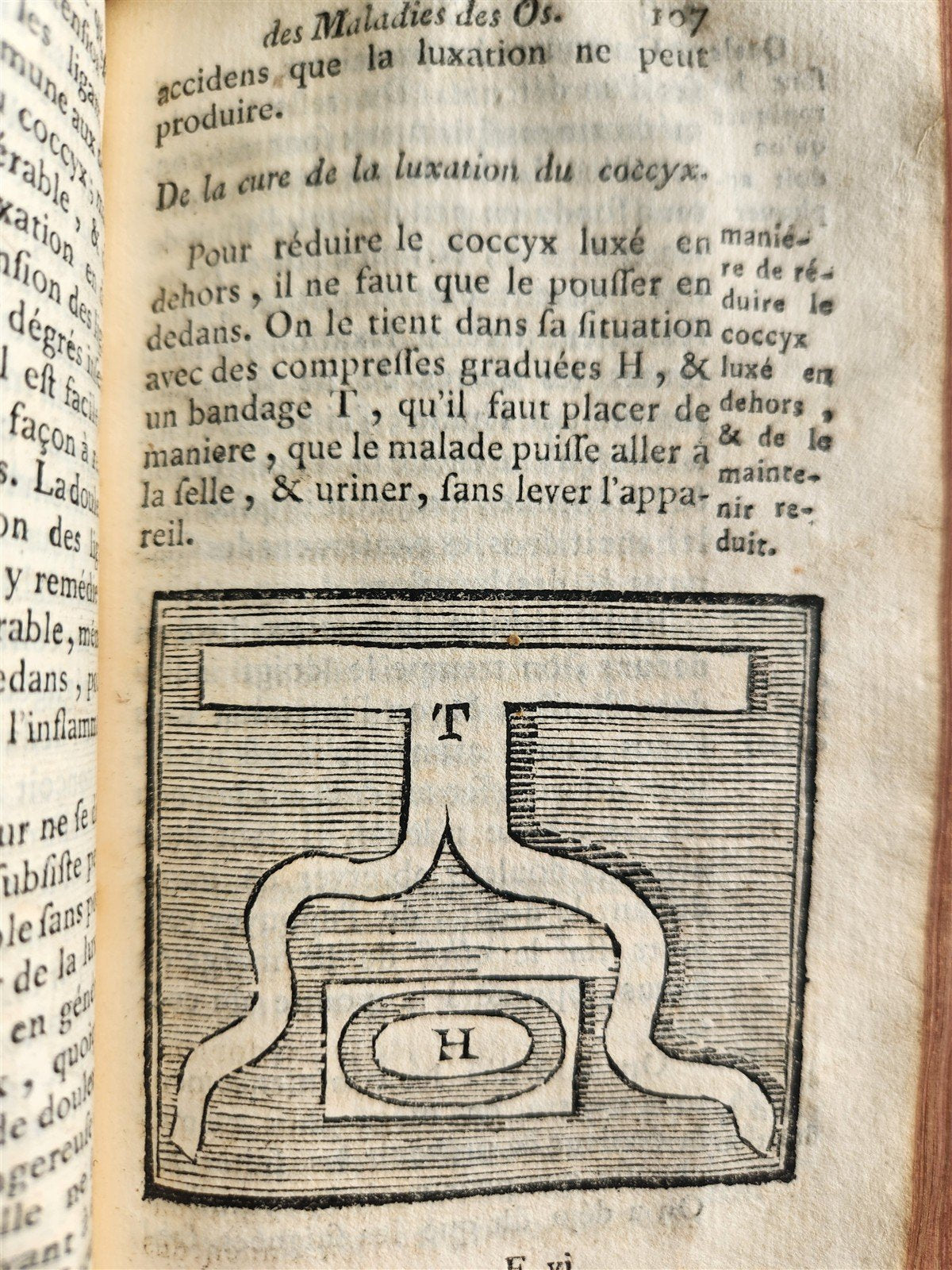 1775 Treatise on Diseases of Bones ILLUSTRATED MEDICAL DEVICES antique 2 VOLS