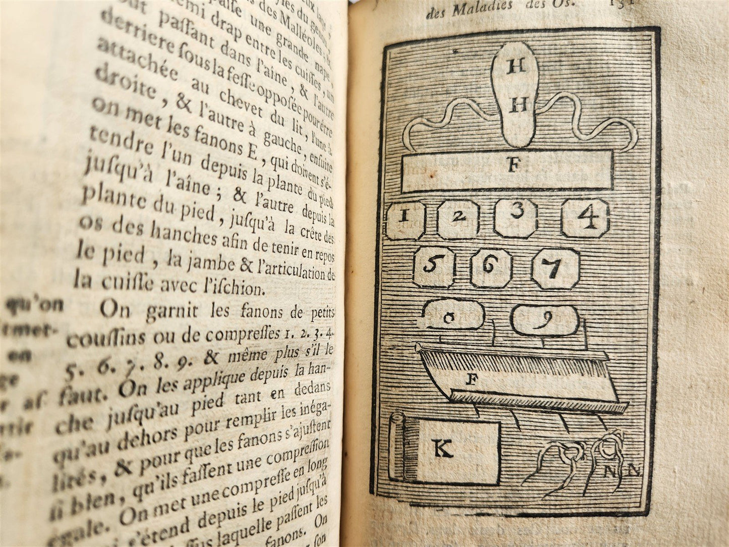 1775 Treatise on Diseases of Bones ILLUSTRATED MEDICAL DEVICES antique 2 VOLS