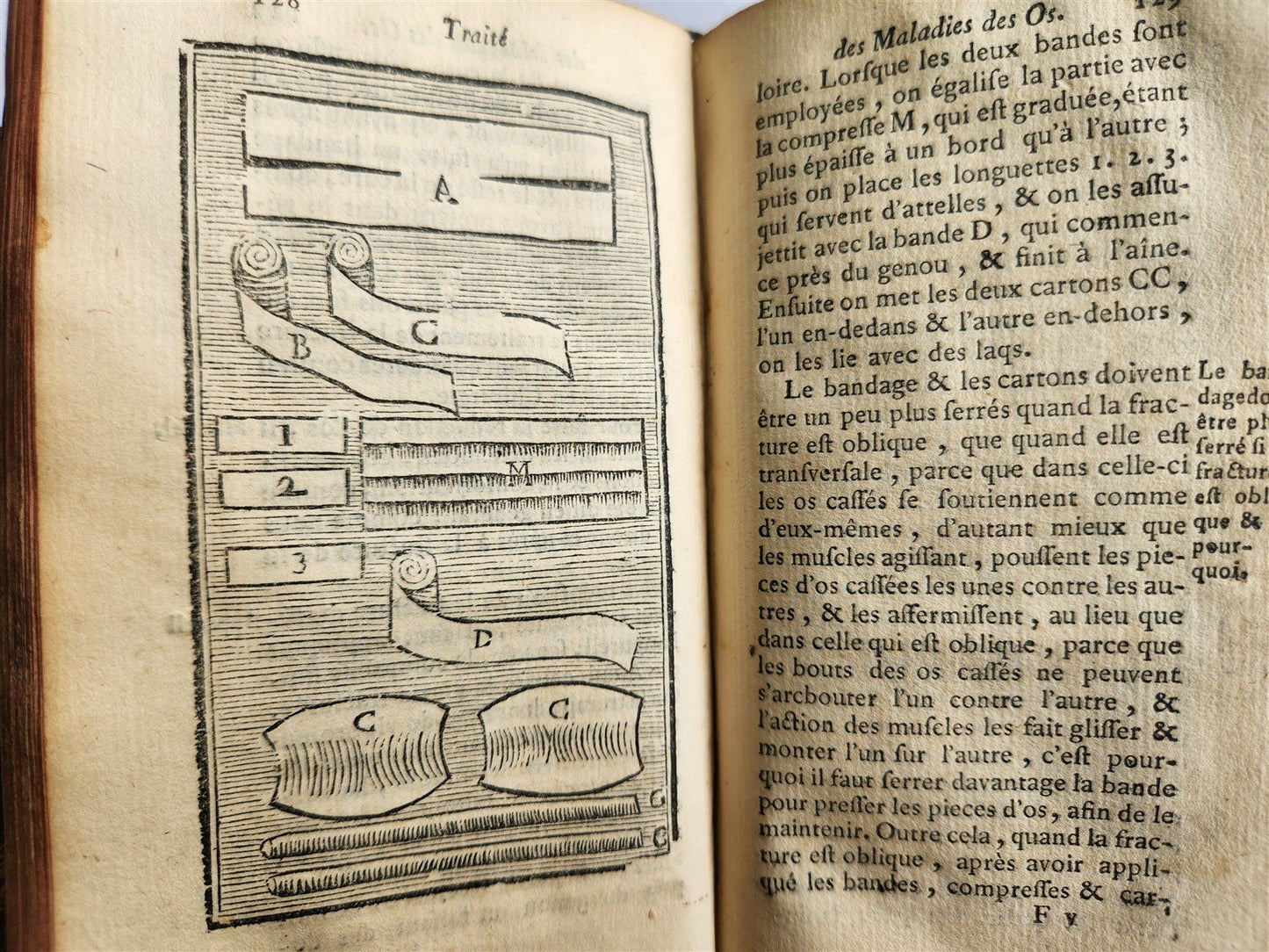 1775 Treatise on Diseases of Bones ILLUSTRATED MEDICAL DEVICES antique 2 VOLS