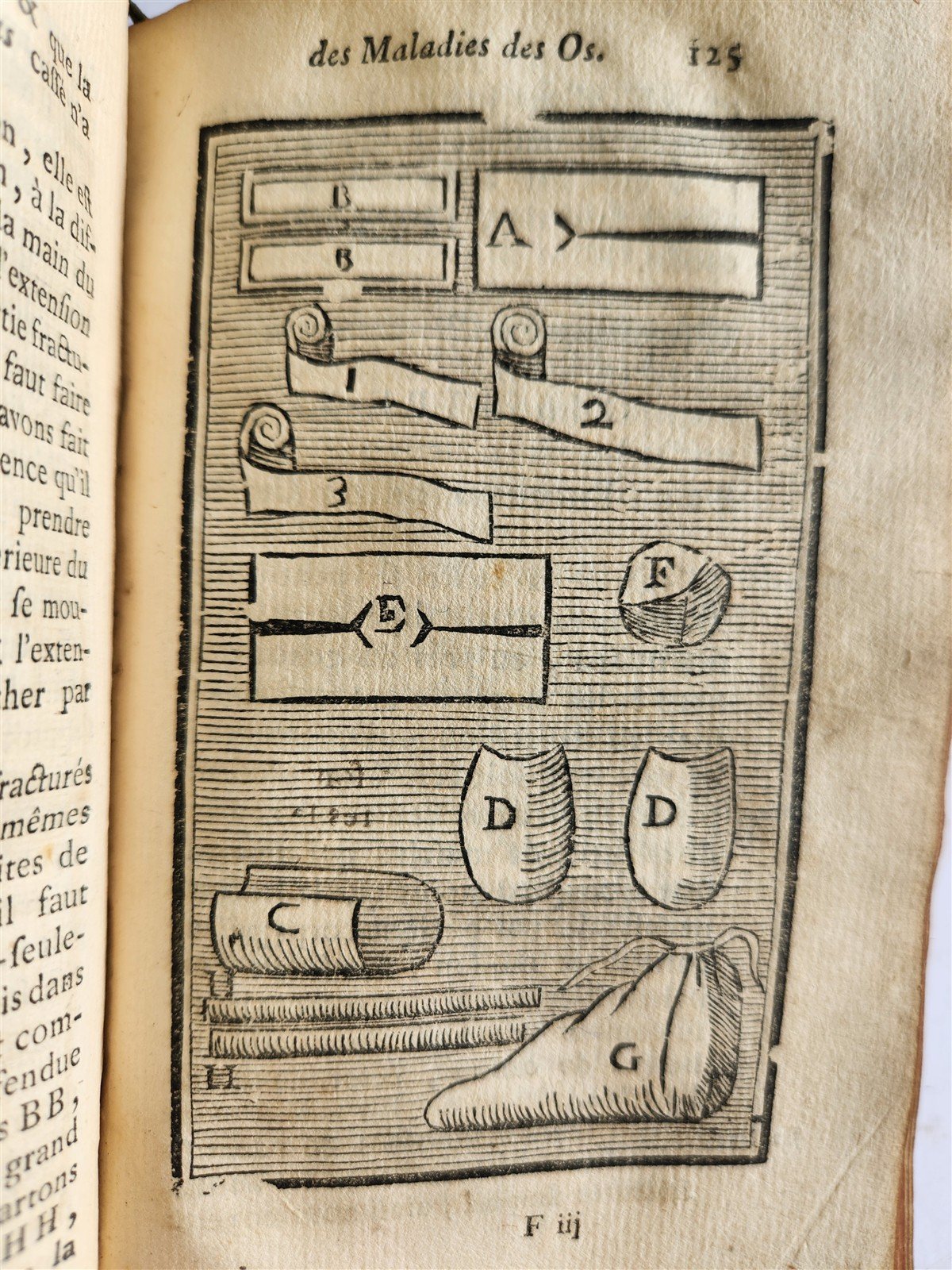 1775 Treatise on Diseases of Bones ILLUSTRATED MEDICAL DEVICES antique 2 VOLS