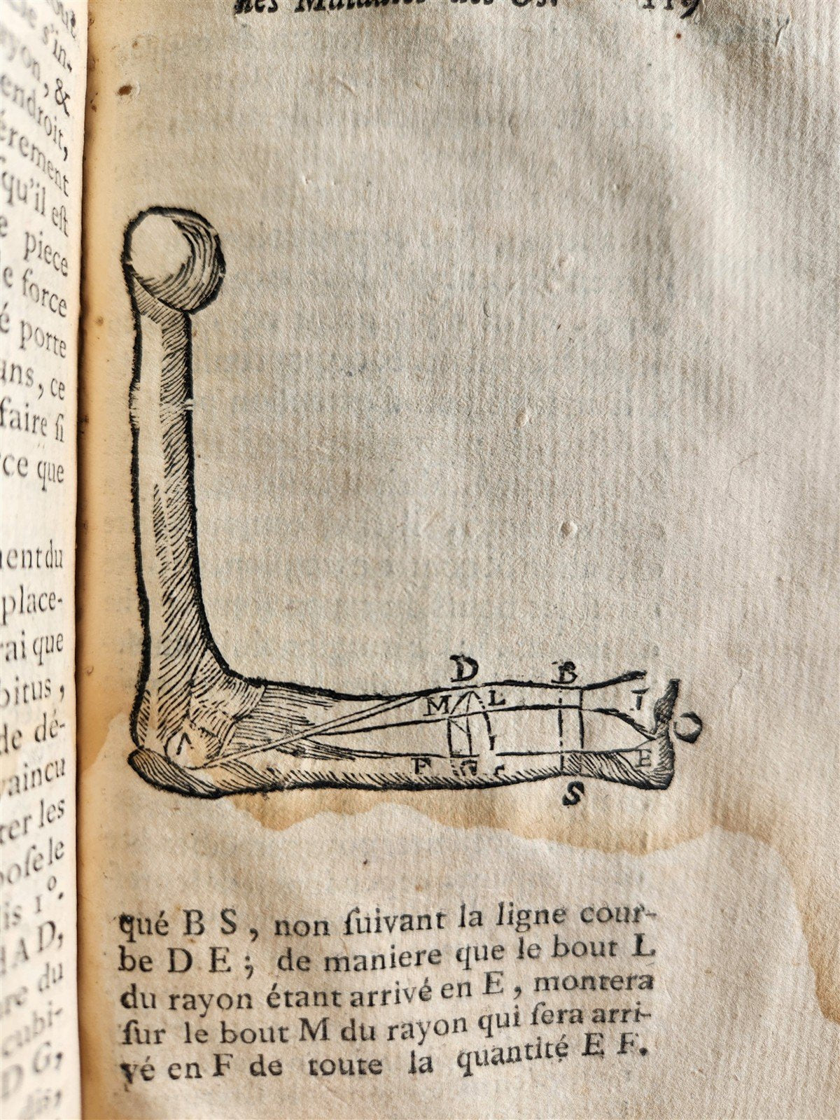 1775 Treatise on Diseases of Bones ILLUSTRATED MEDICAL DEVICES antique 2 VOLS